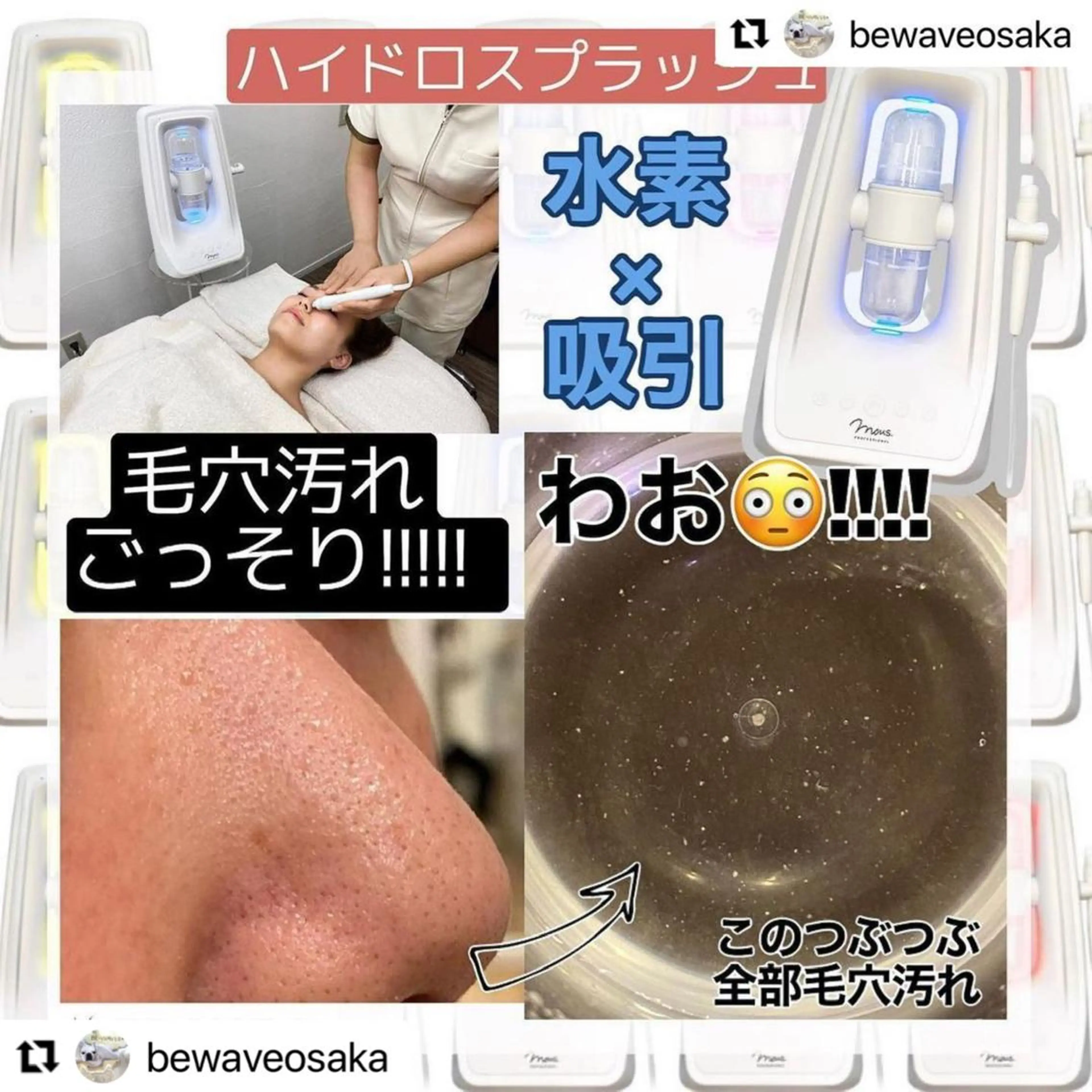 脱毛・エステサロン LuLuNのエステ・リラクイメージ