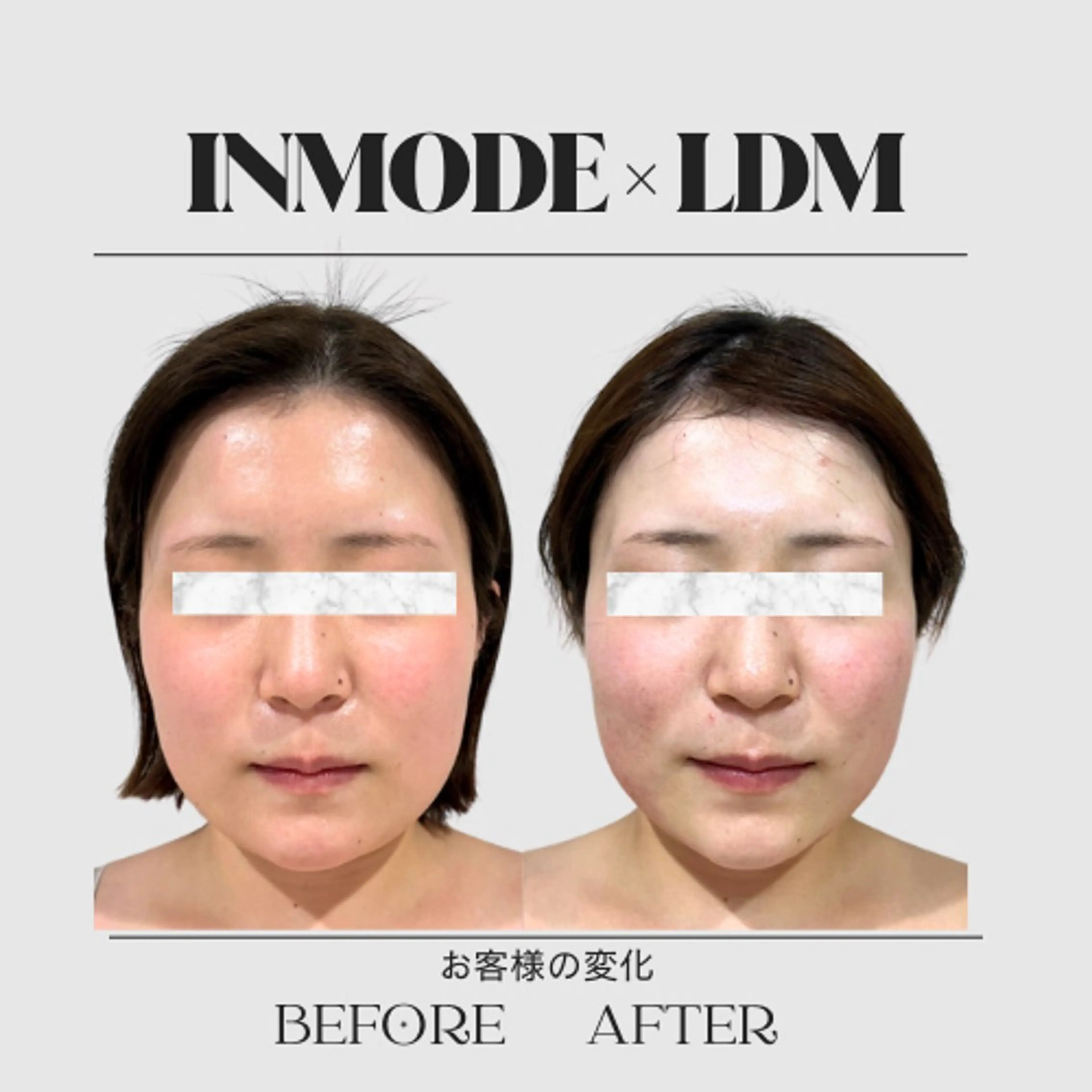 エステ aimer 服部のその他イメージ