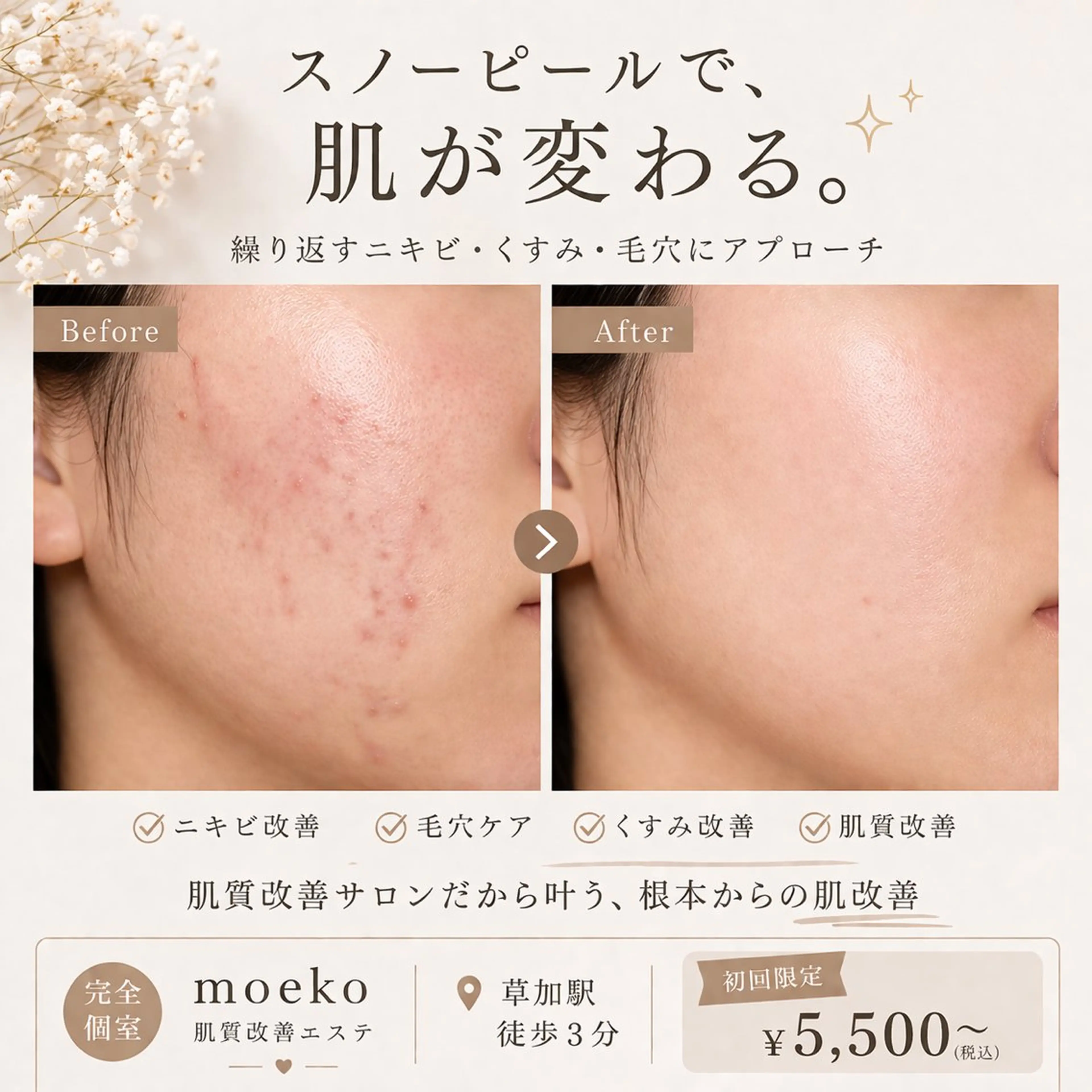 エステ ピーリングケア 🤍moekoのエステ・リラクイメージ