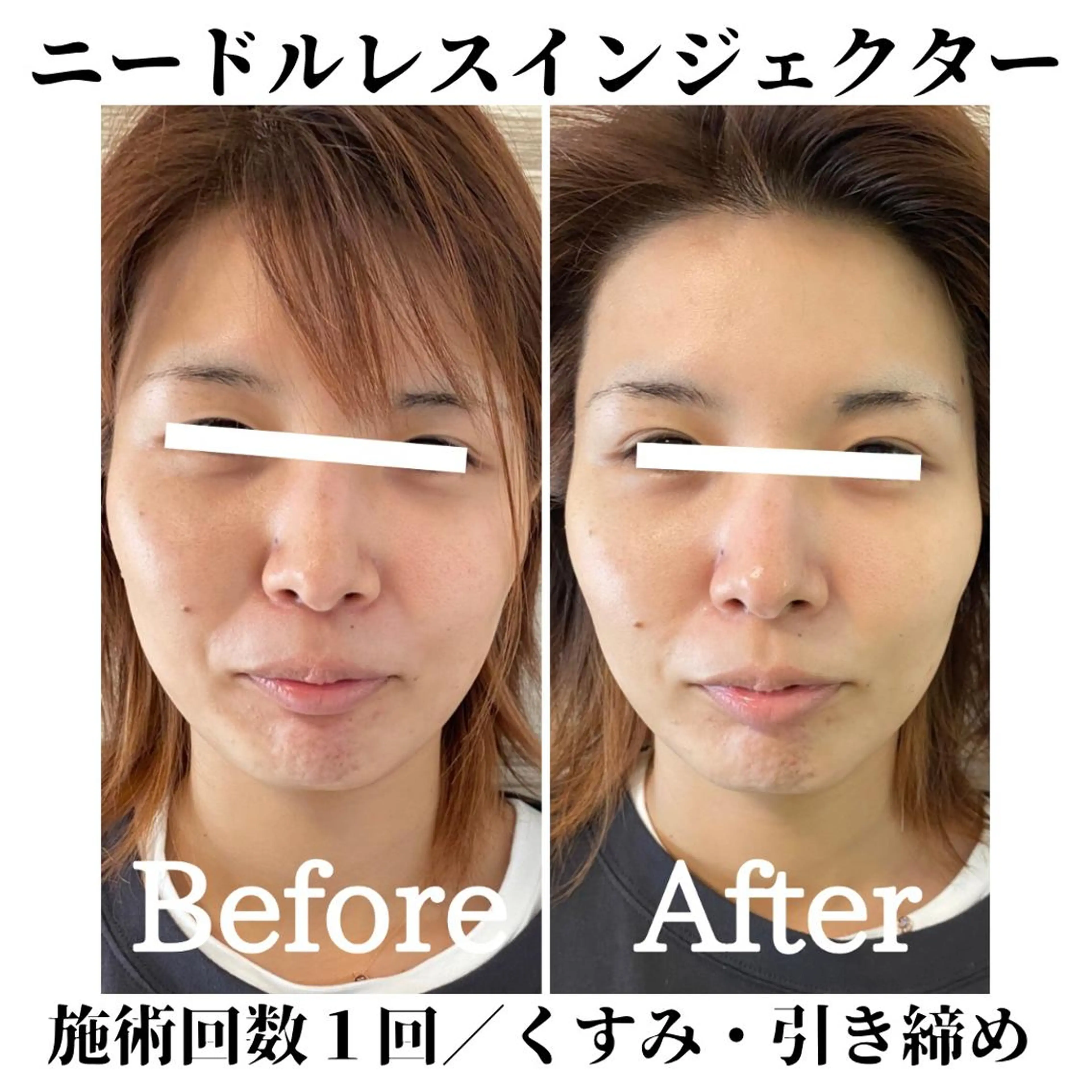 トータルビューティー サロンSalaのマツエク・マツパデザイン