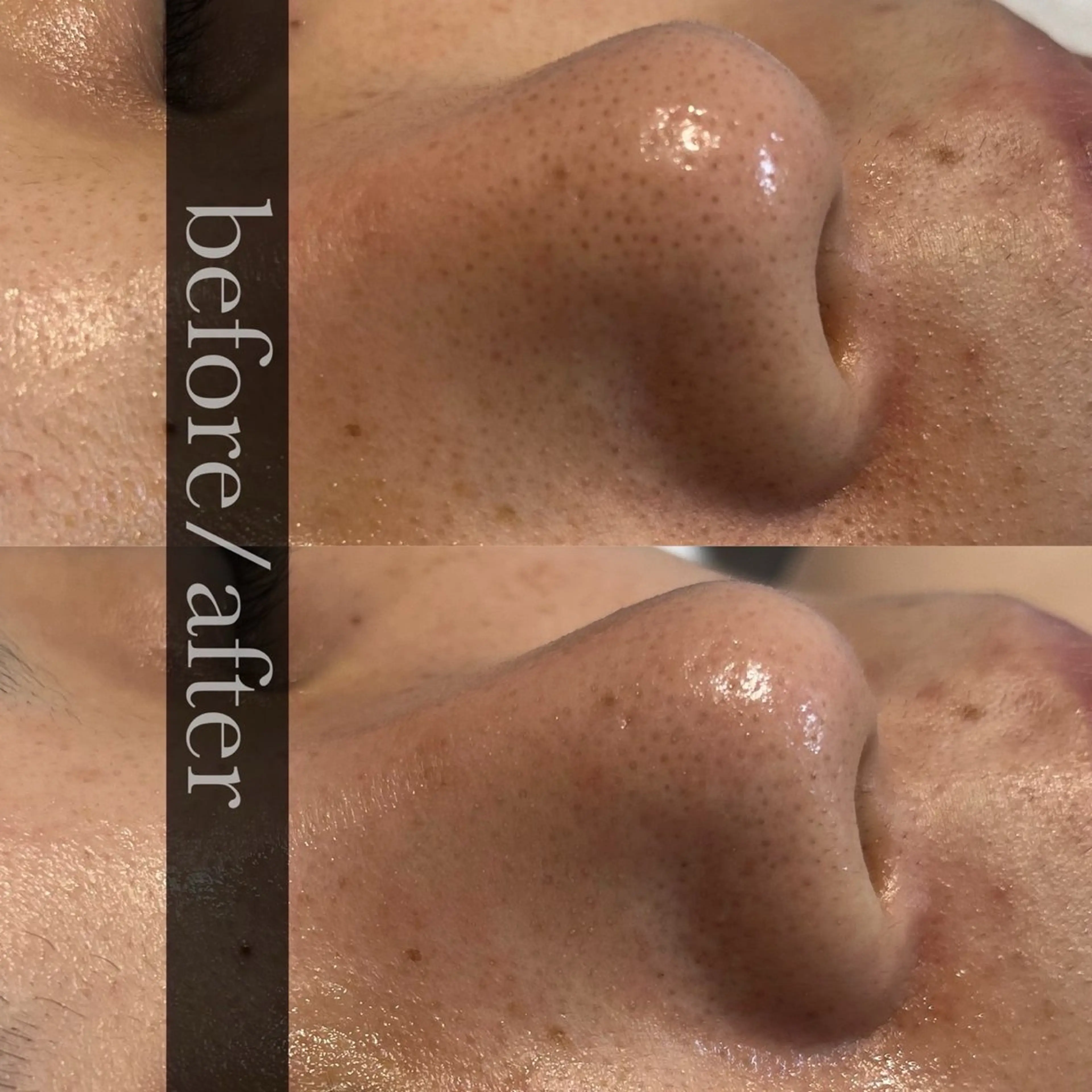 FOXYLASH inoueのエステ・リラクイメージ