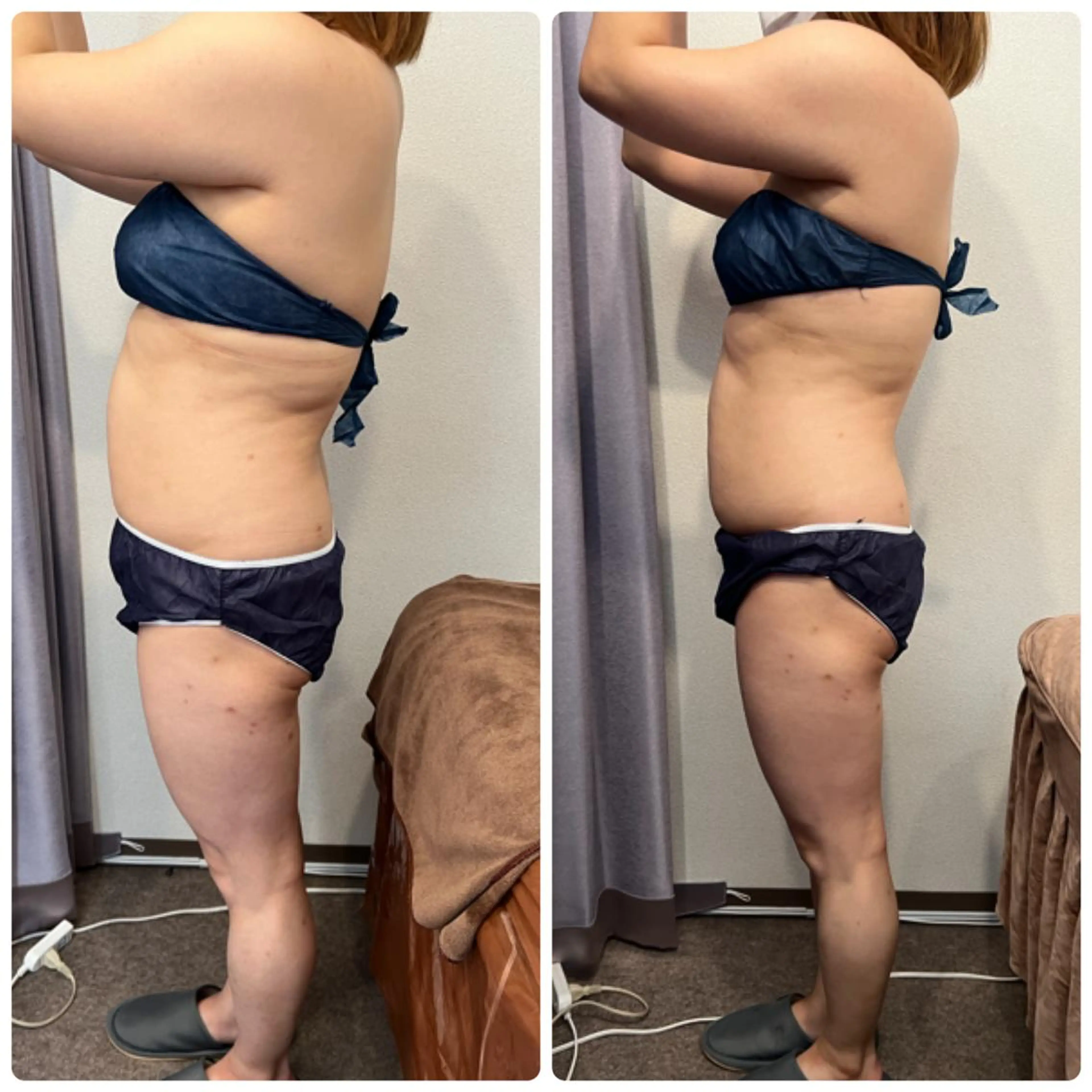 FLEUR 2号店のエステ・リラクイメージ