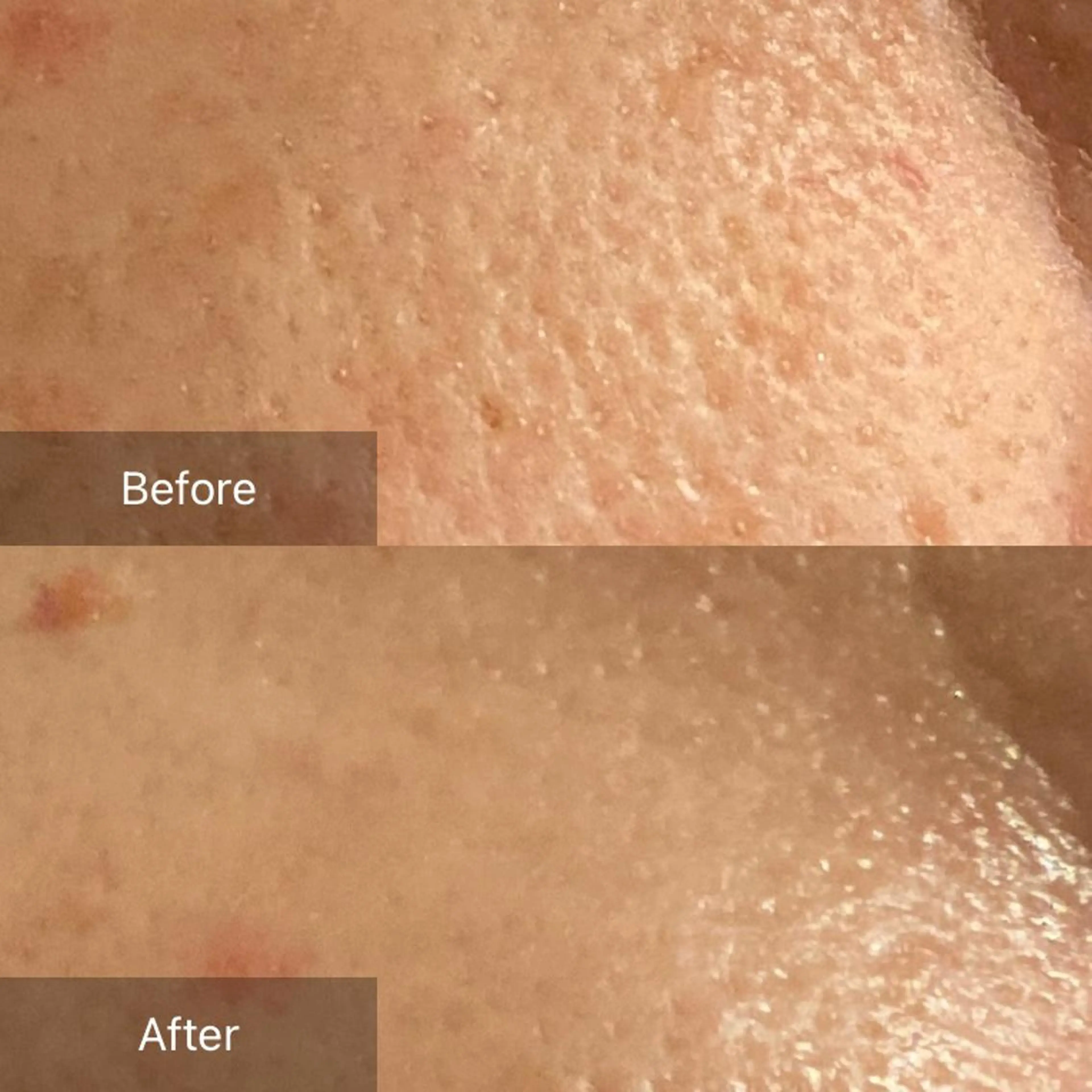 毛穴から始める肌メン テマンダリンオレンジのエステ・リラクイメージ