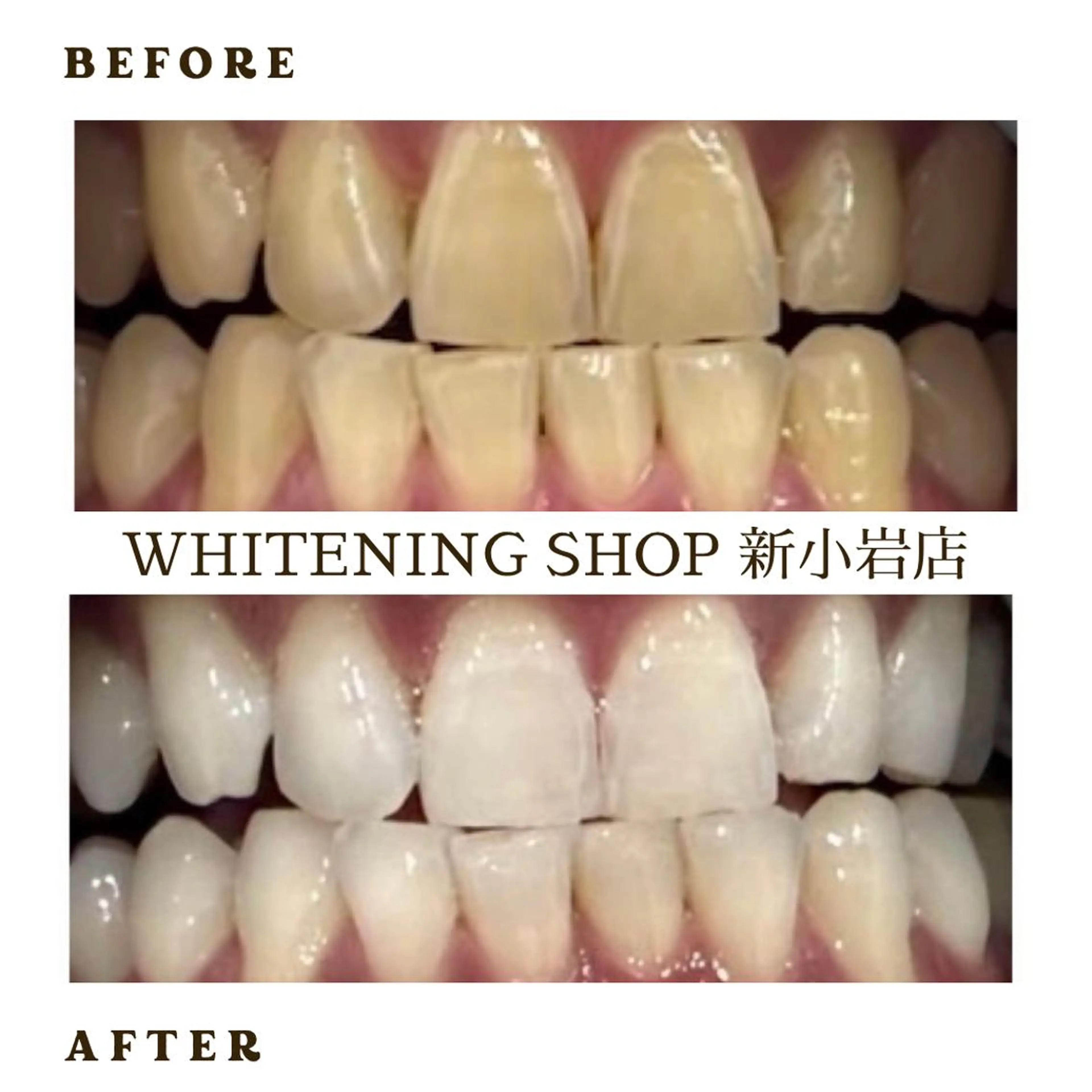 メンズ その他 ホワイトニング ショップ新小岩店のその他イメージ