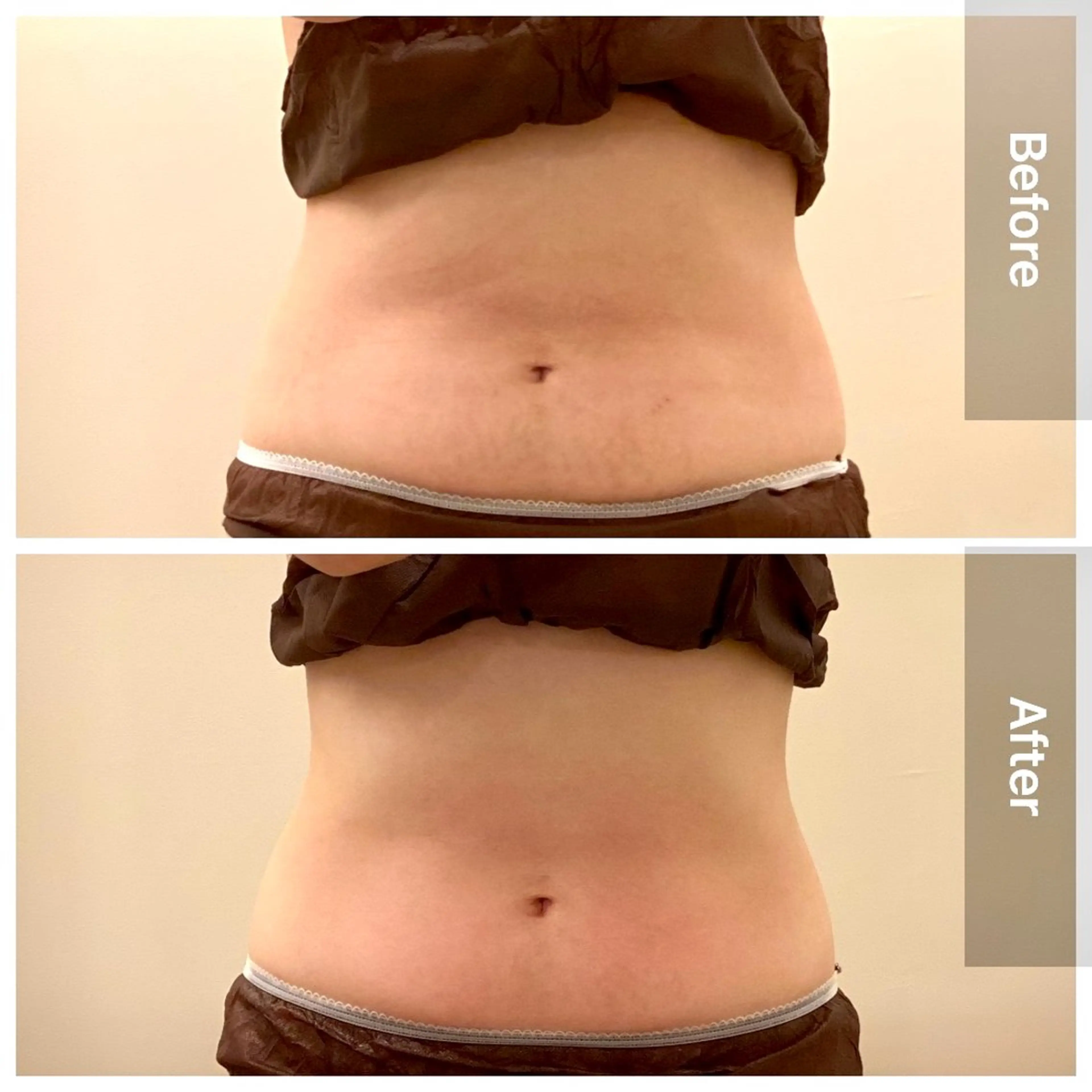 美容鍼/ヘッドスパ/ 💎さかもとのエステ・リラクイメージ