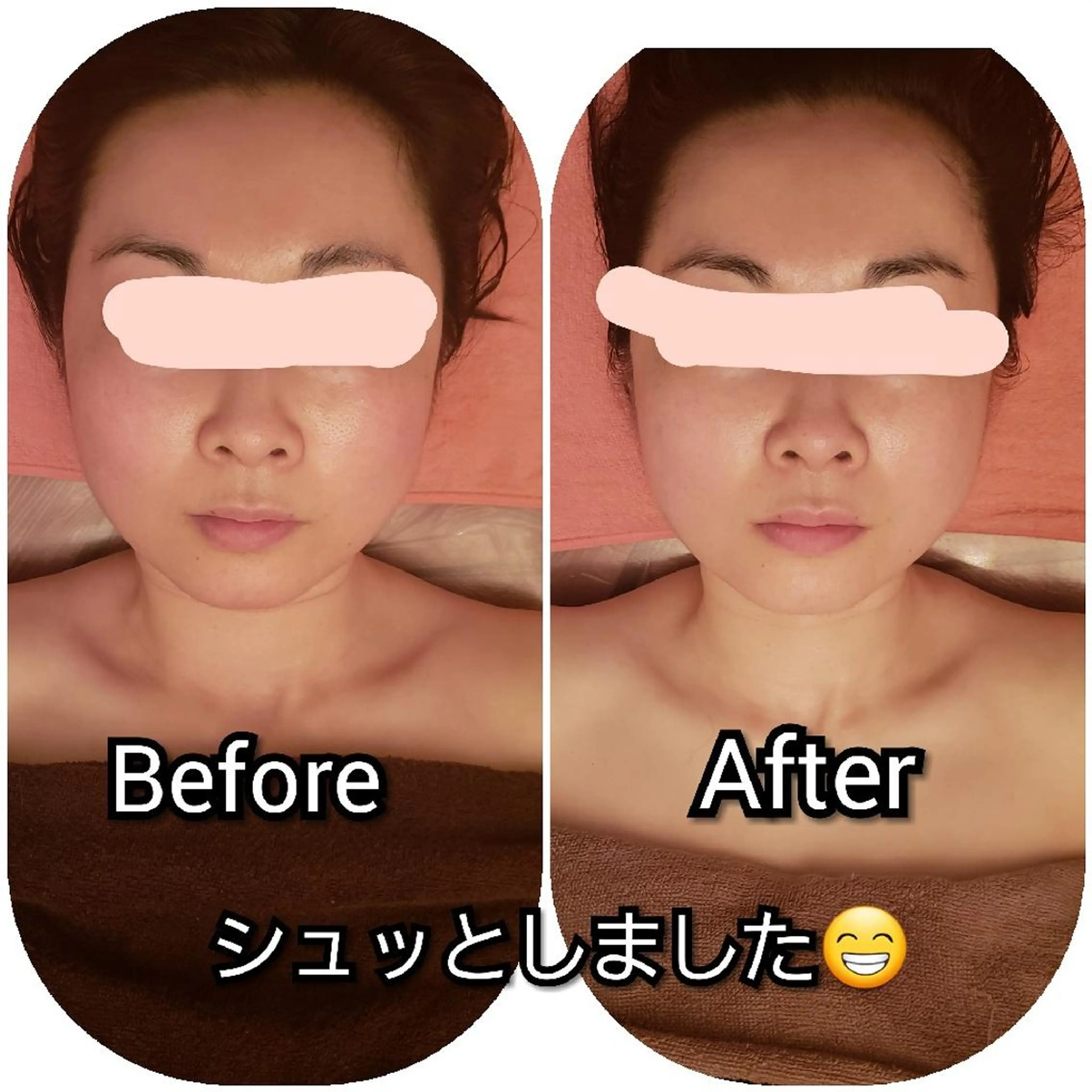 毛穴ケア くすみ肌 ハーブピーリングのエステ・リラクイメージ