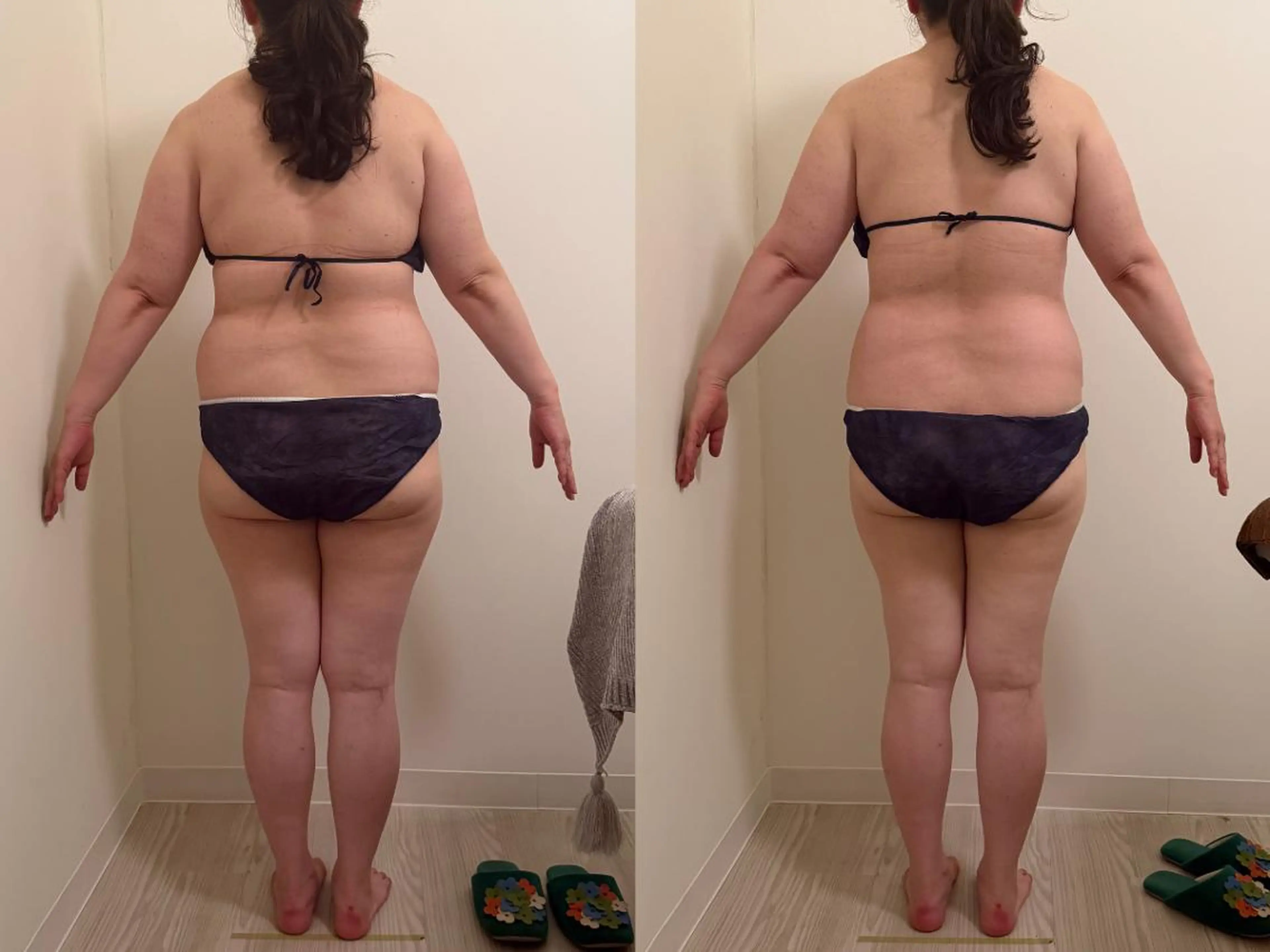 【人気No.1】眠れる痩身エステ(90分)|ミニモ限定 初回9,800円の写真