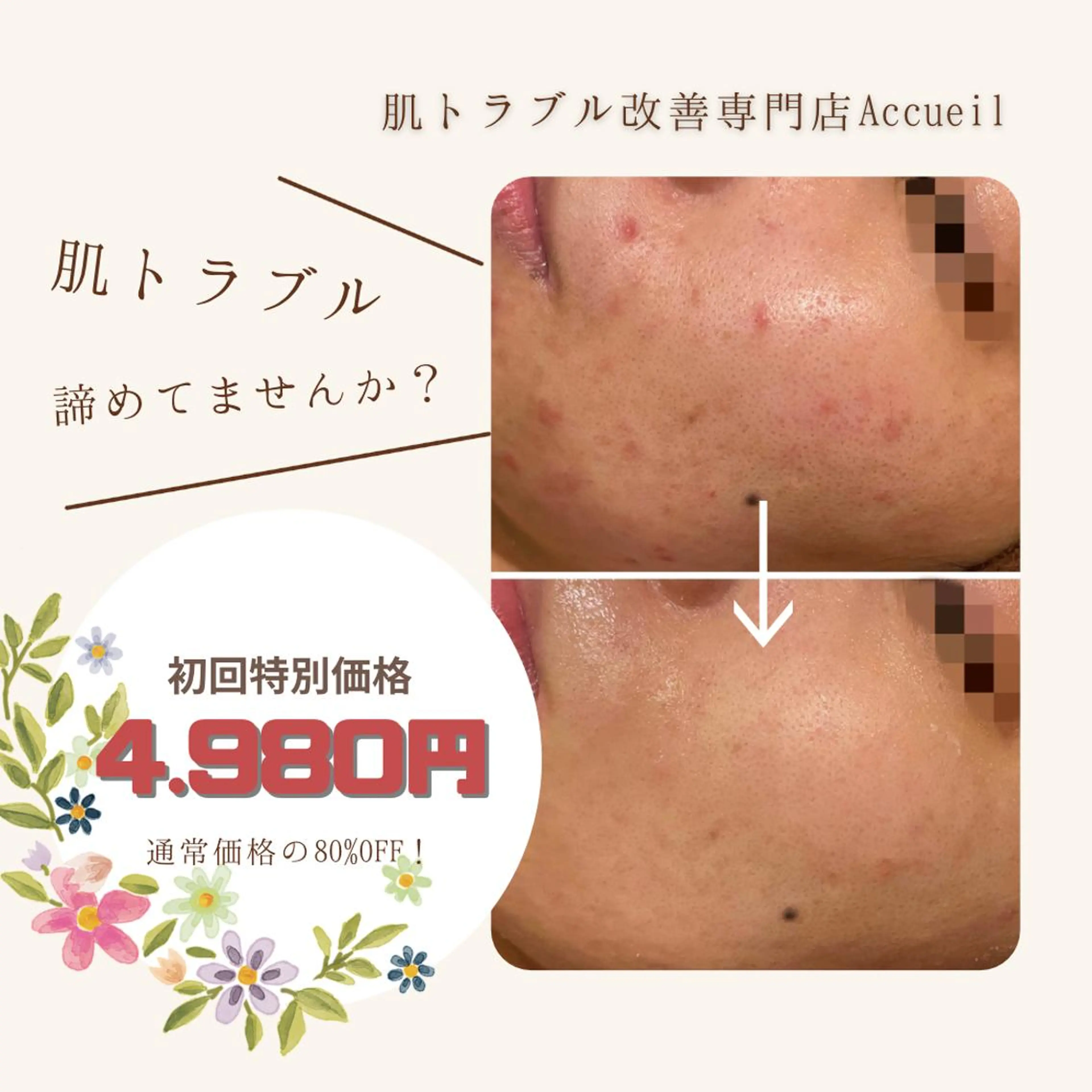 セミロング カラー パーマ ヘアアレンジ メンズ キッズ ネイル マツエク・マツパ アイブロウ エステ リラク ニキビ特化型エステ 🍋最短で肌質改善のエステ・リラクイメージ