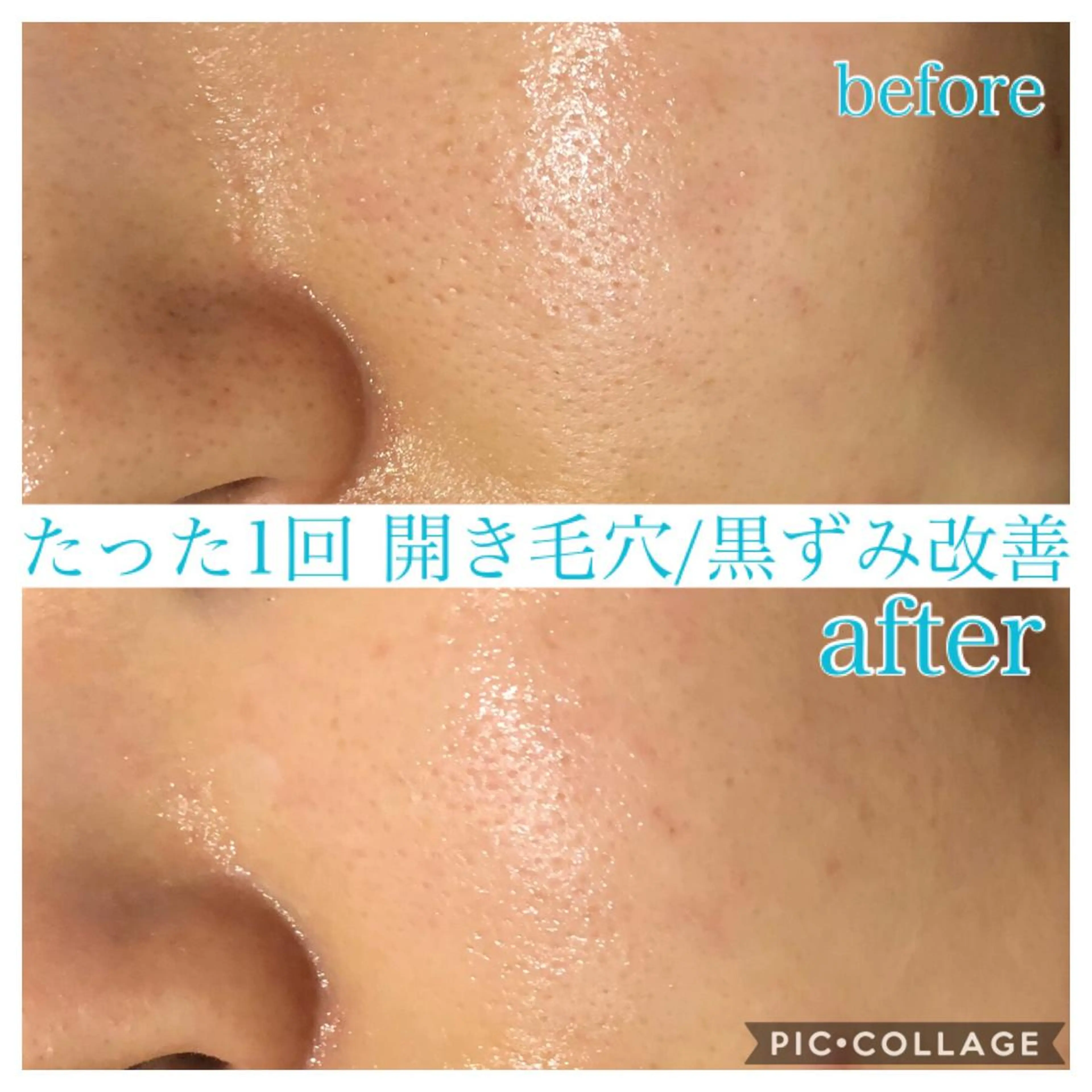 ミディアム カラー パーマ ヘアアレンジ キッズ ネイル マツエク・マツパ エステ リラク EnsorClair 代表 野口真央のエステ・リラクイメージ