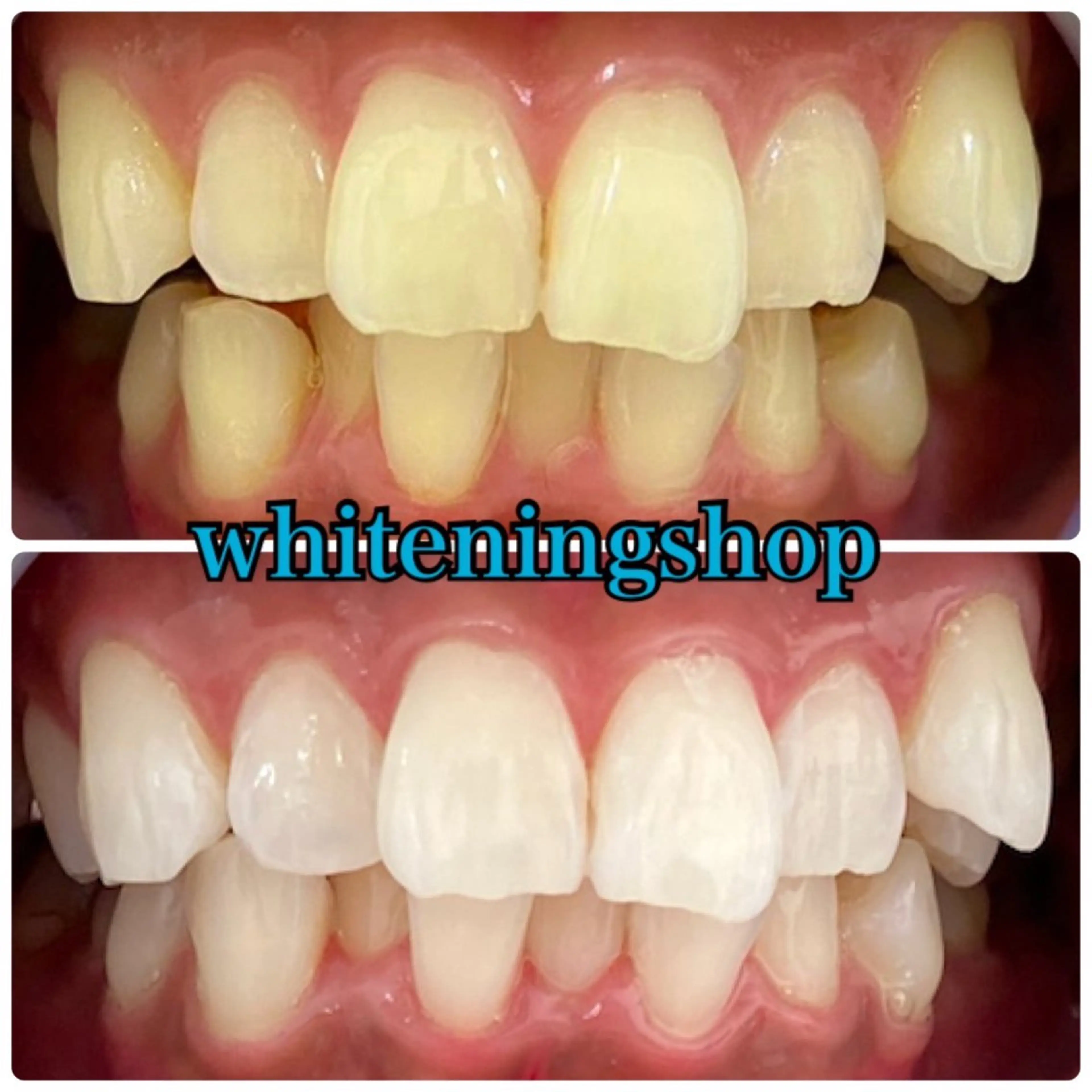 エステ リラク ホワイトニング ショップ吉祥寺店のエステ・リラクイメージ