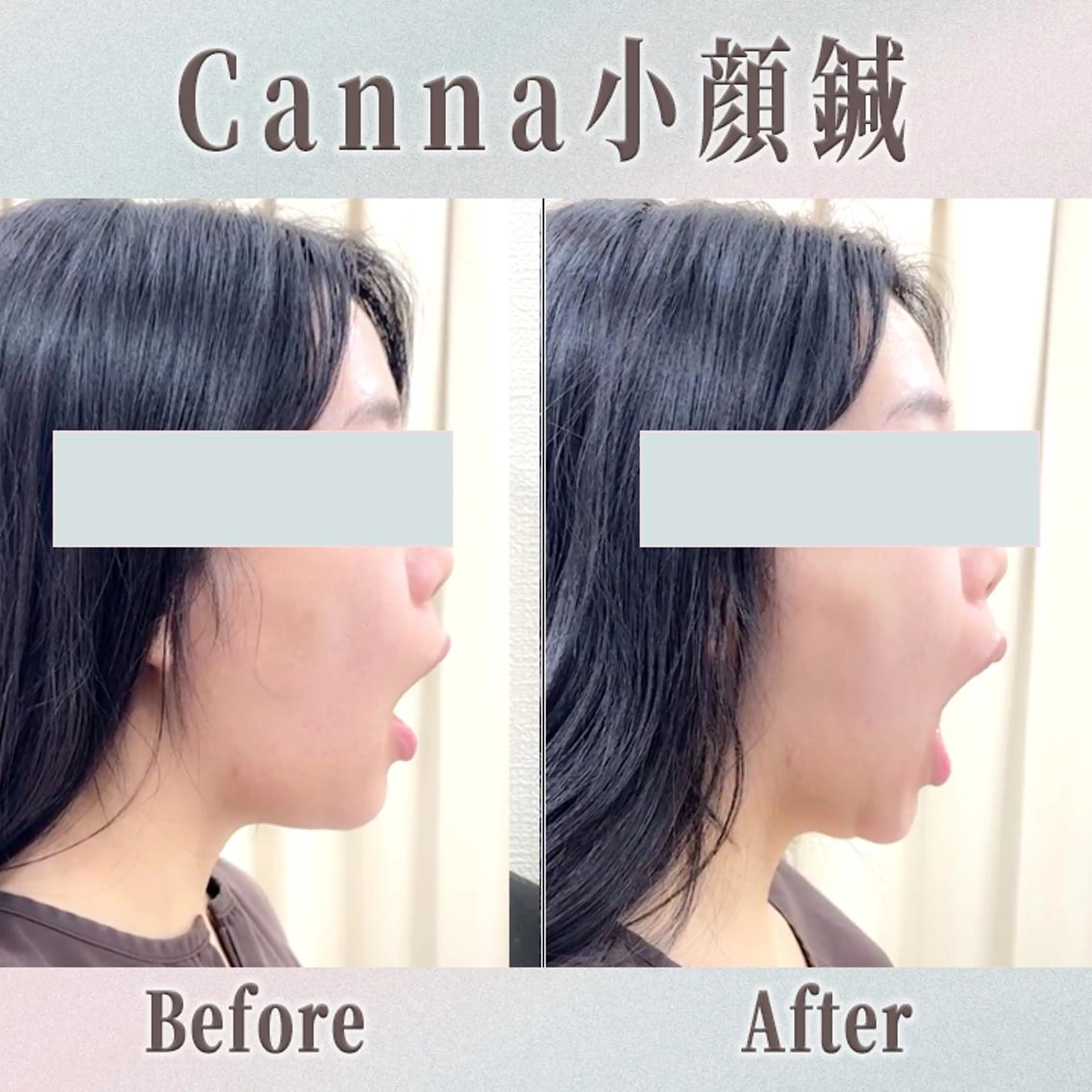 エステ リラク 【美容鍼・小顔鍼】 鍼灸師　森原拓磨のエステ・リラクイメージ