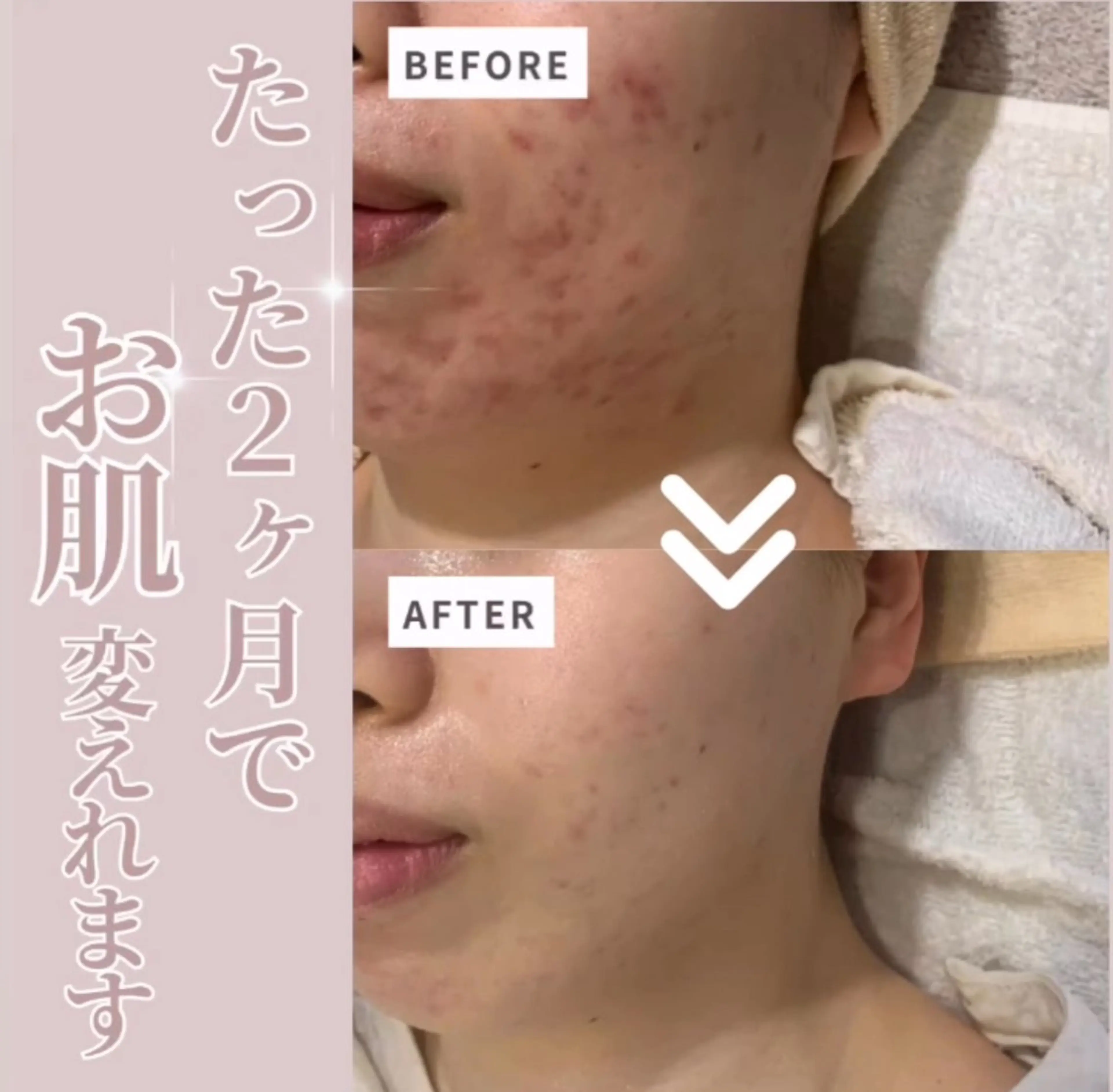 肌質改善🫧 みゆのエステ・リラクイメージ