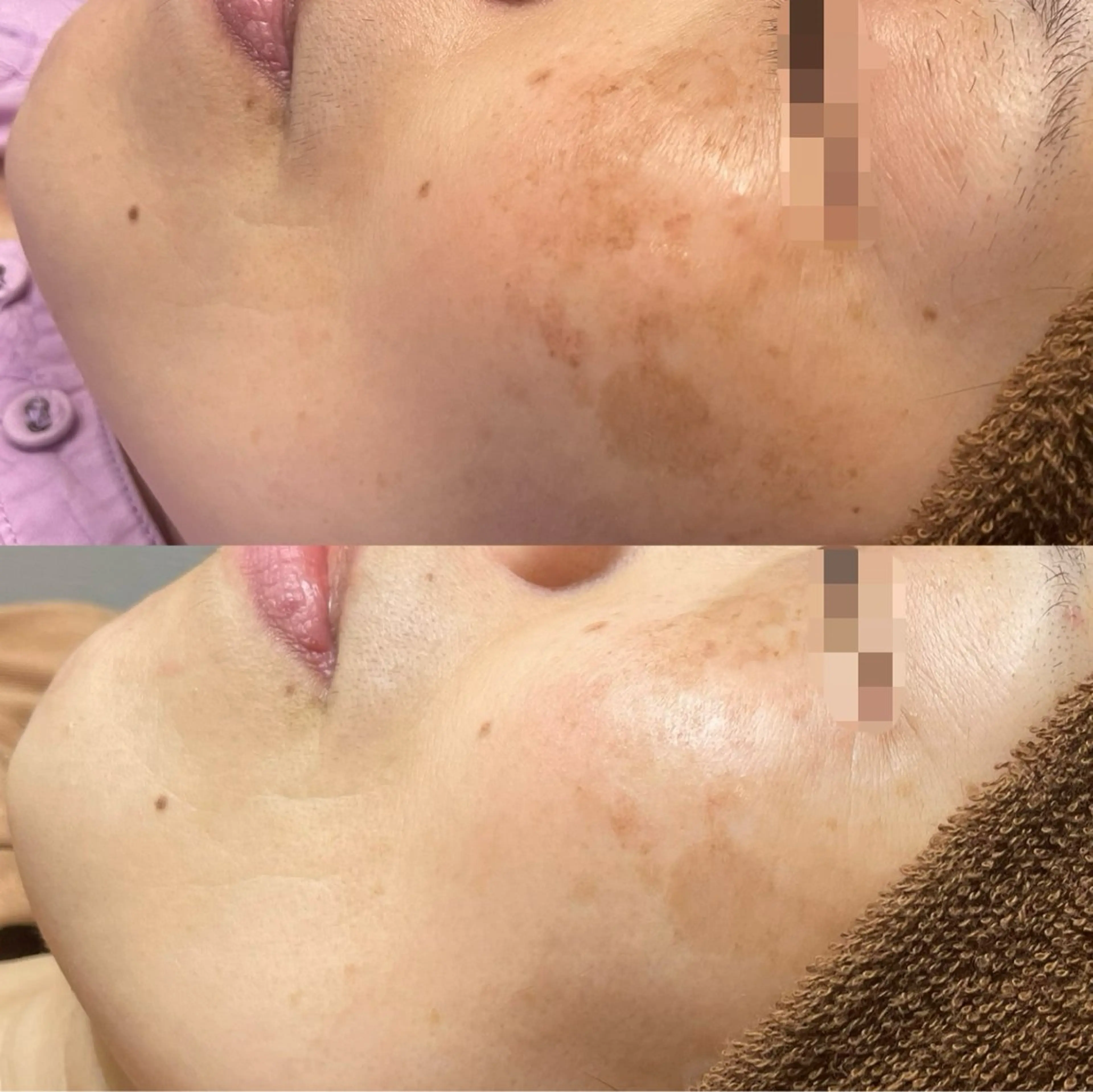 シミケア専門店モルセラ所属・シミケア専門店 モルセラのエステ・リラクイメージ