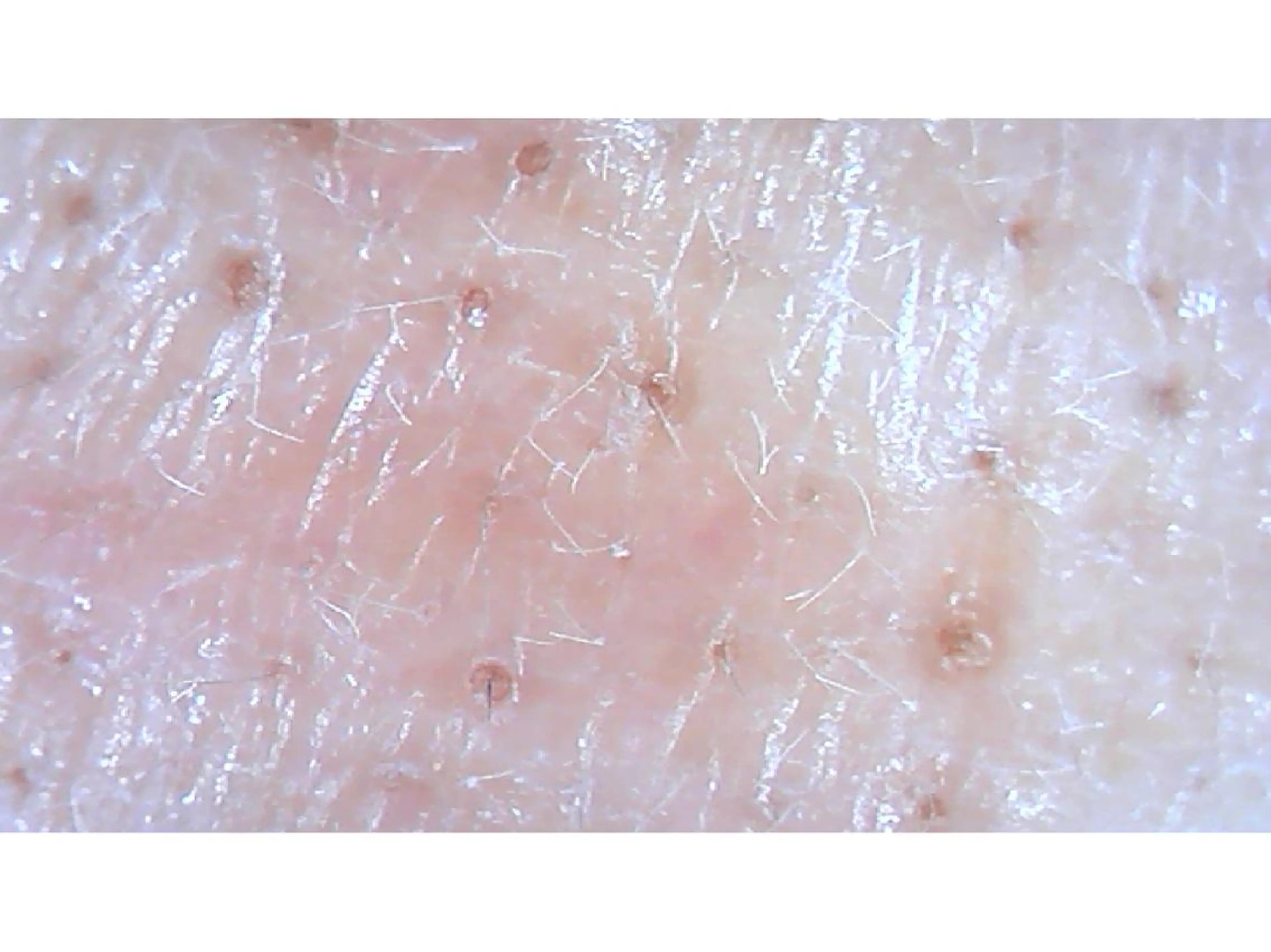 エステ リラク 宮野 麻綺のエステ・リラクイメージ