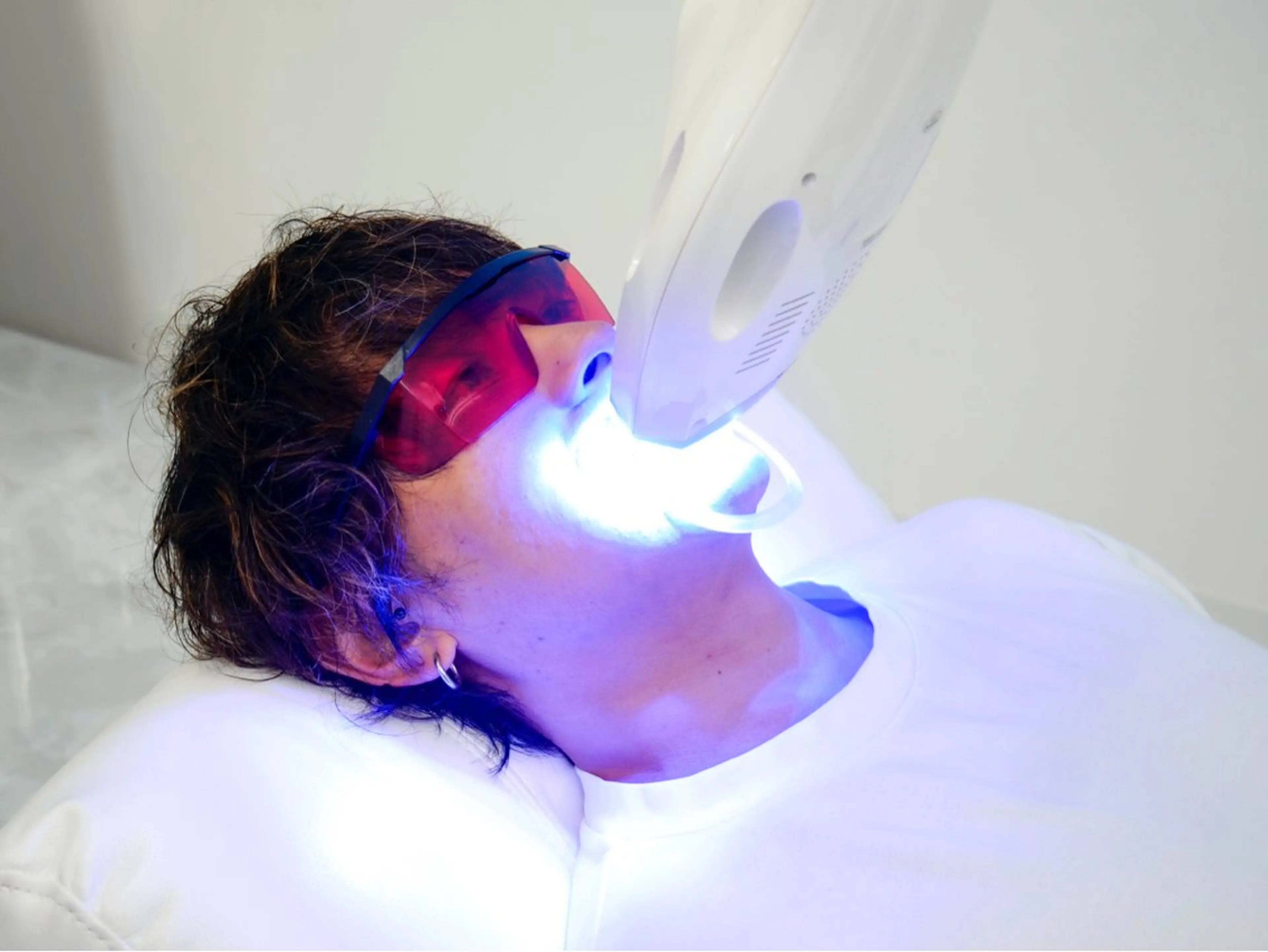 セルフホワイトニング16分×2回照射¥9,960→¥6,970の写真