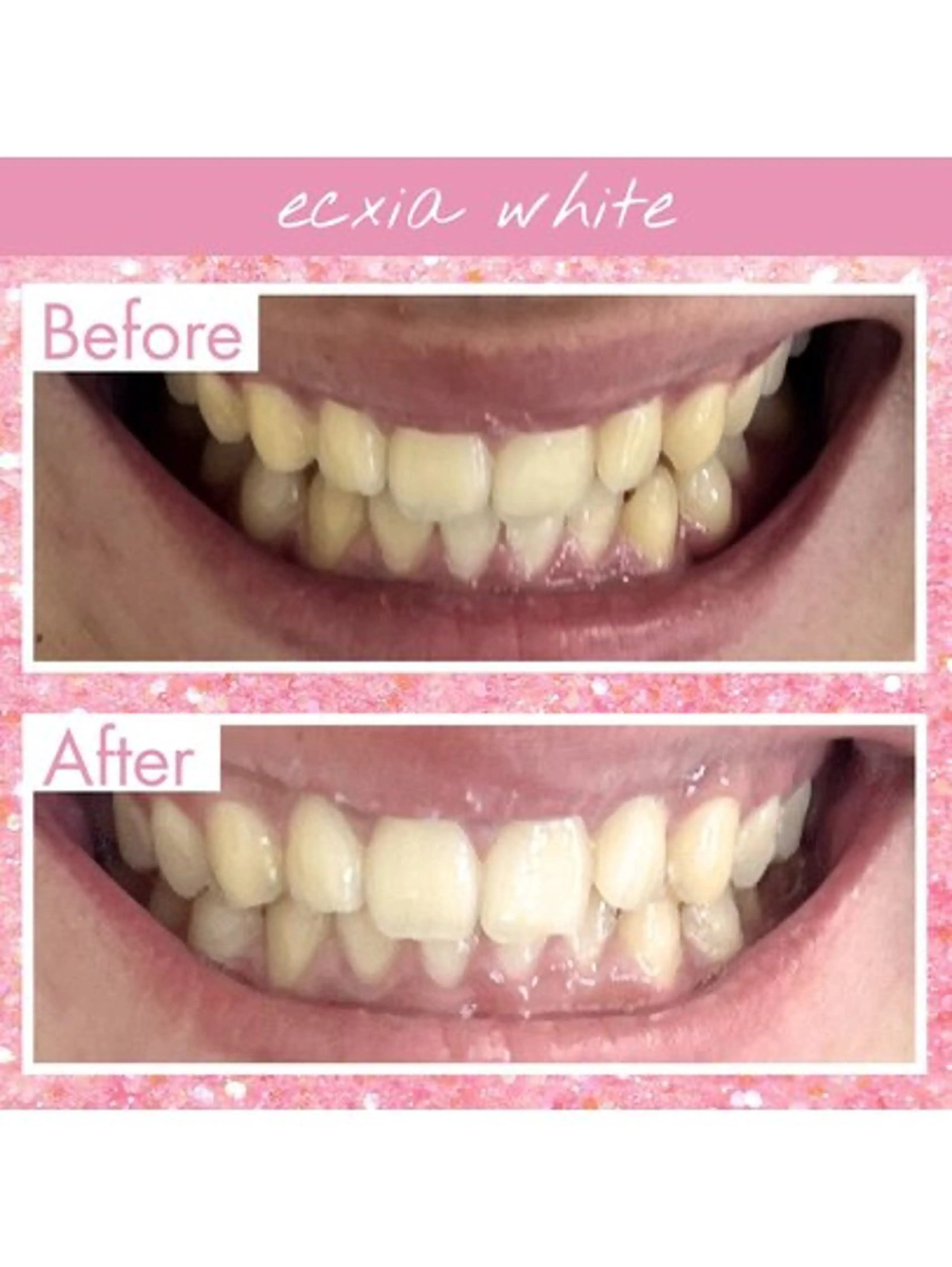 エクシア ホワイトニング西条店のその他イメージ