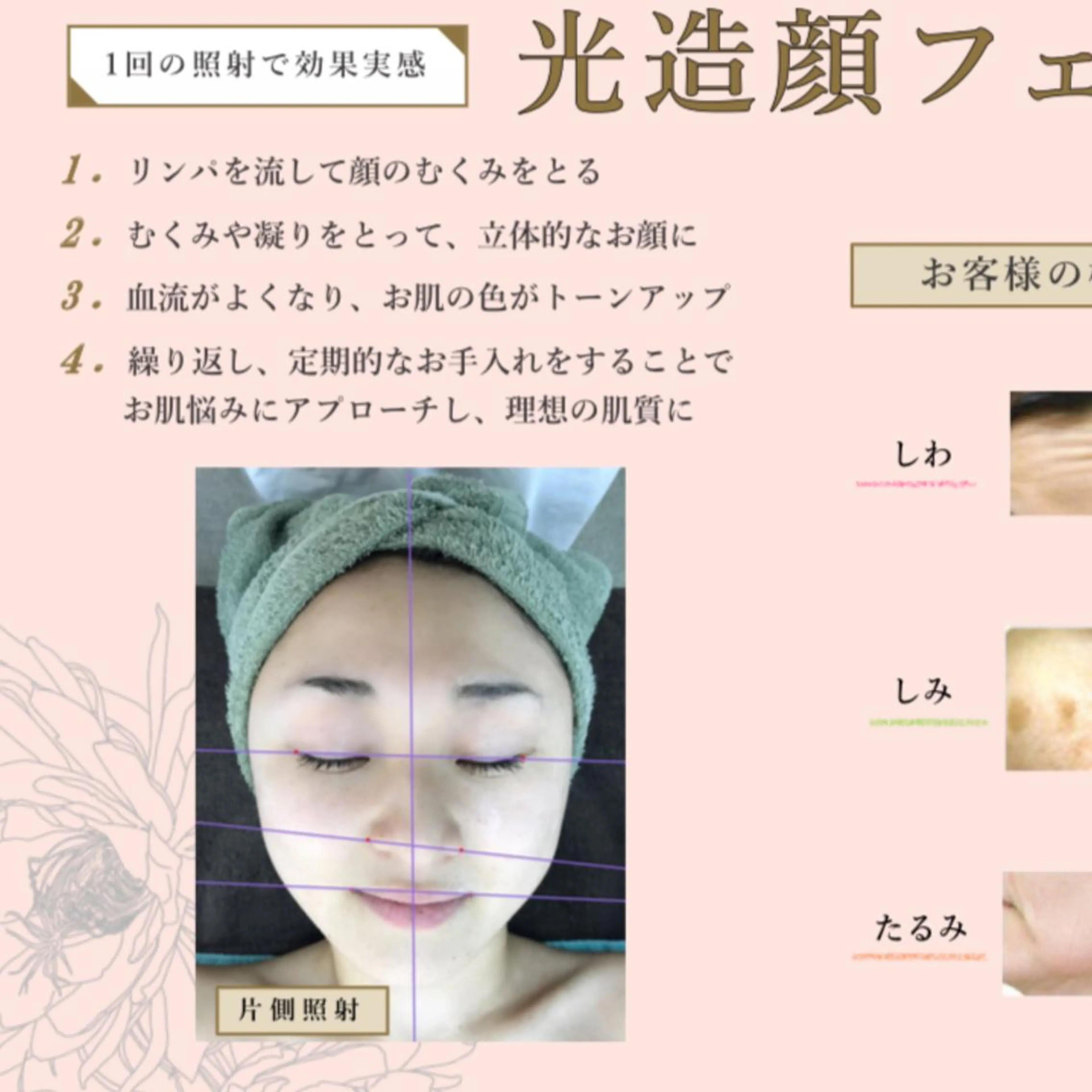 Merchi 🕊のエステ・リラクイメージ