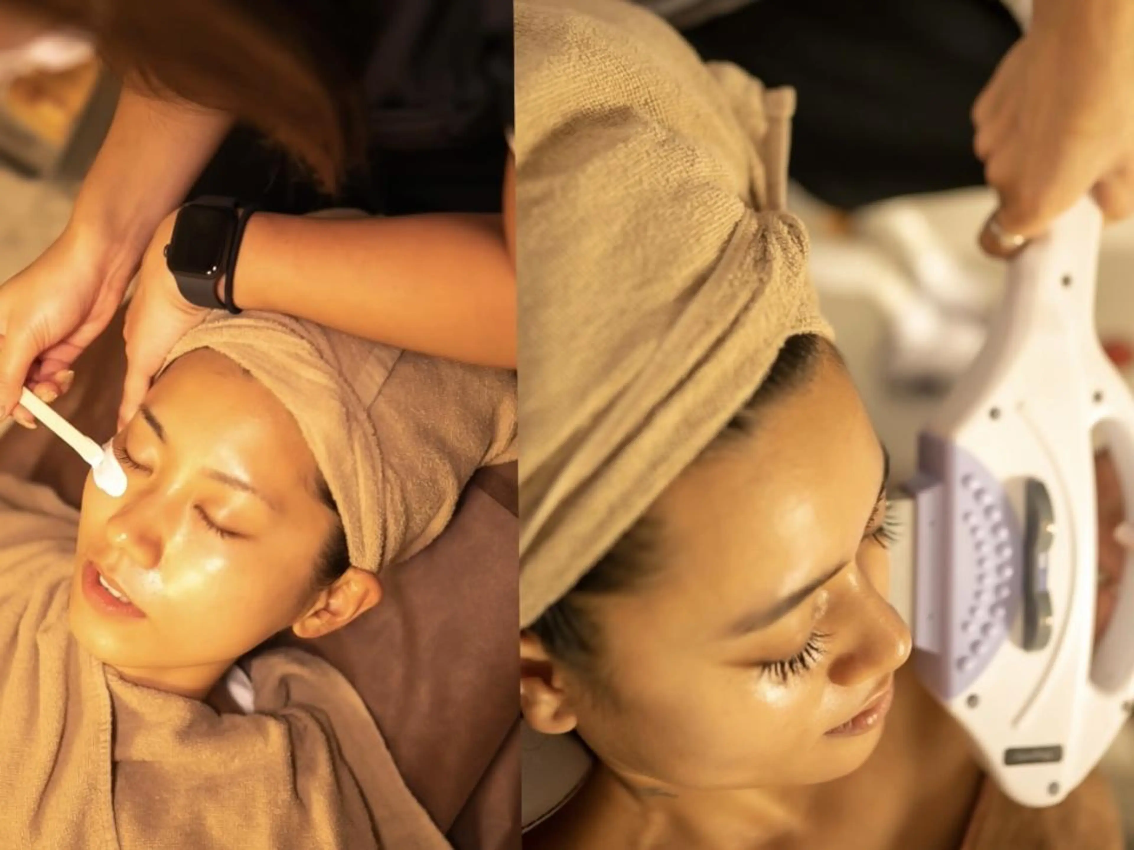 キッズ メンズ 脱毛 Epina 千葉店 【エピナ】のエステ・リラクイメージ