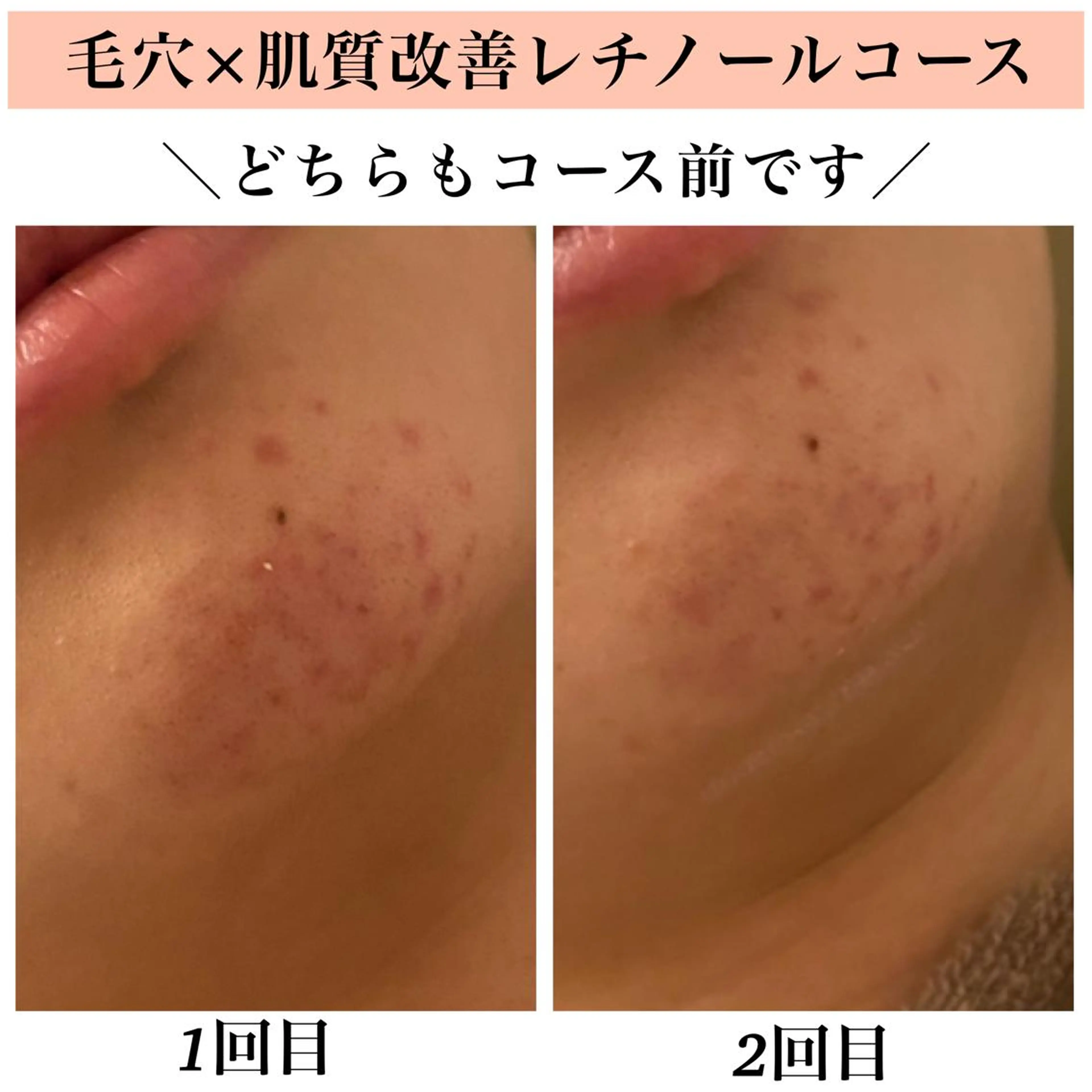 エステ リラク Bellesthe （ベルエステ）のエステ・リラクイメージ