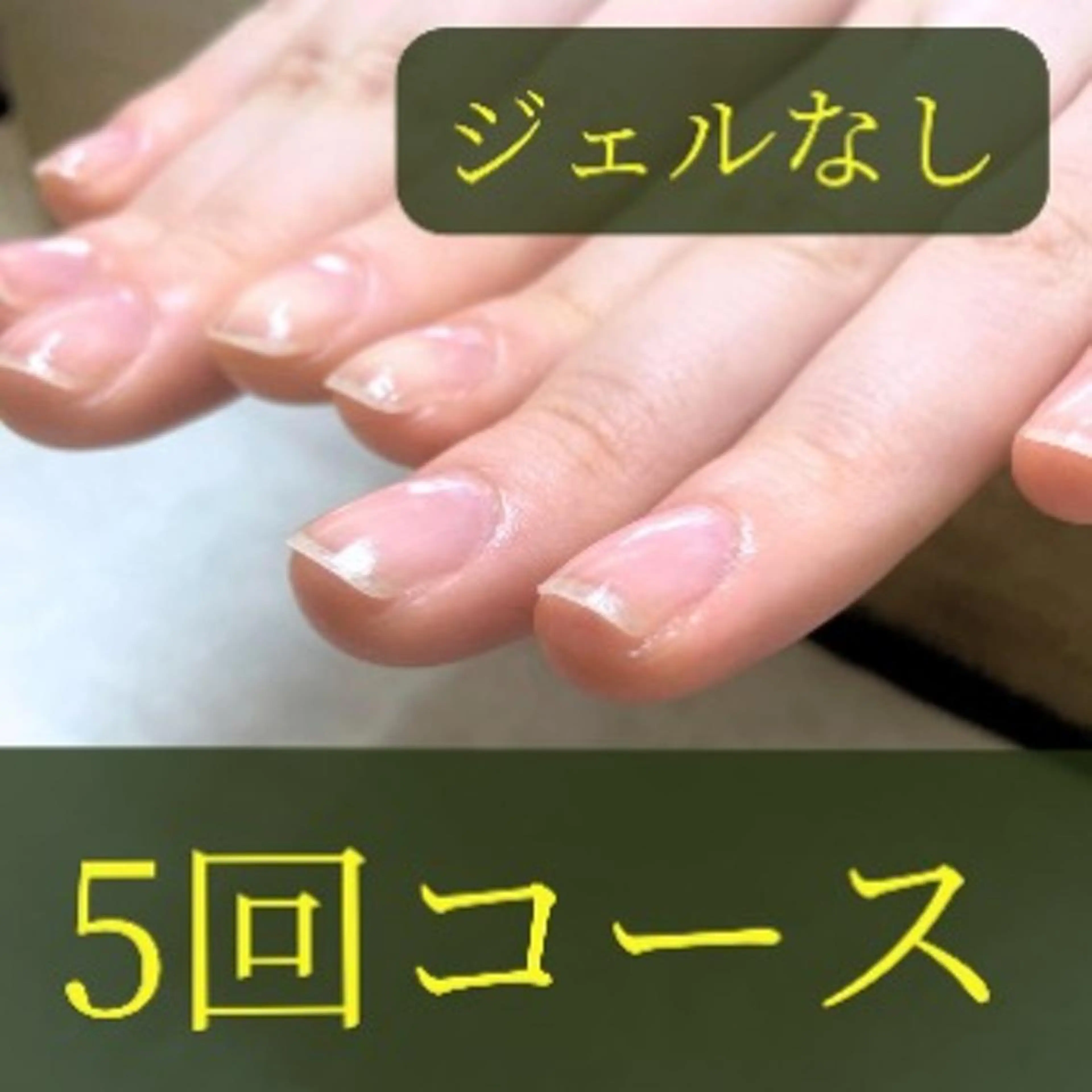 5回コース深爪-縦長10(75分)の写真