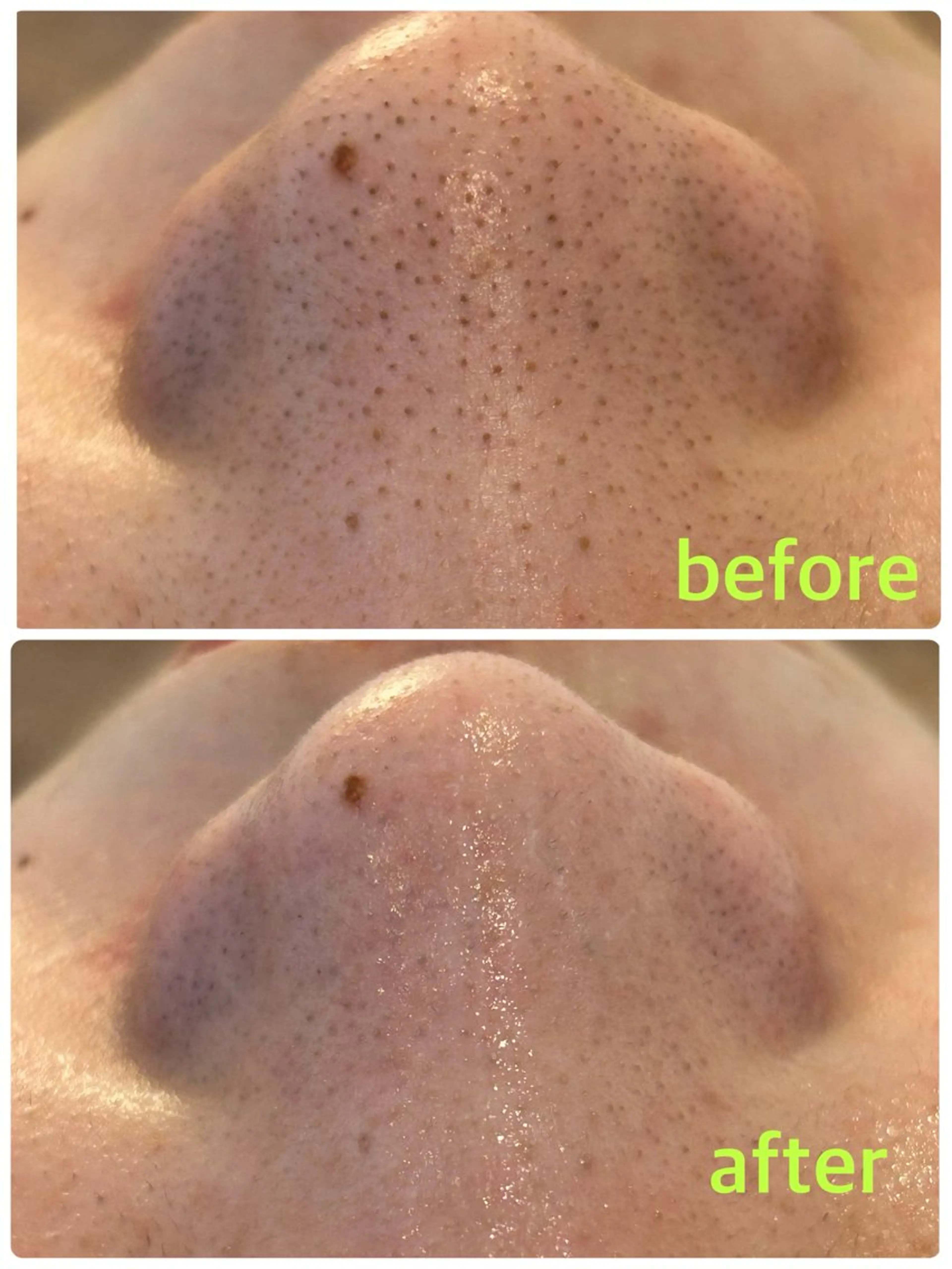 【初回ミニモ限定】毛穴洗浄モニターの写真