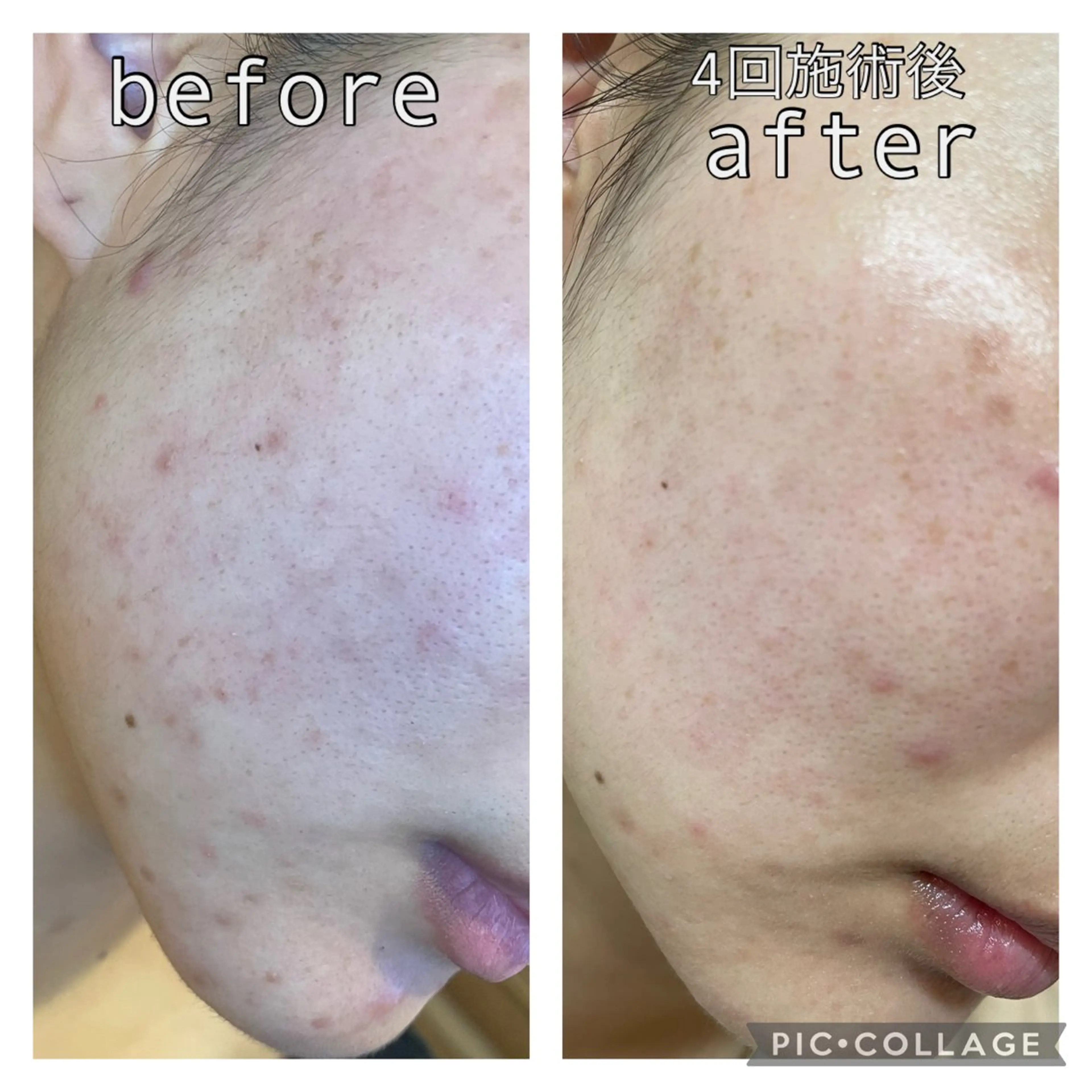 エステ 毛穴改善サロン d'Alba大阪住吉のエステ・リラクイメージ