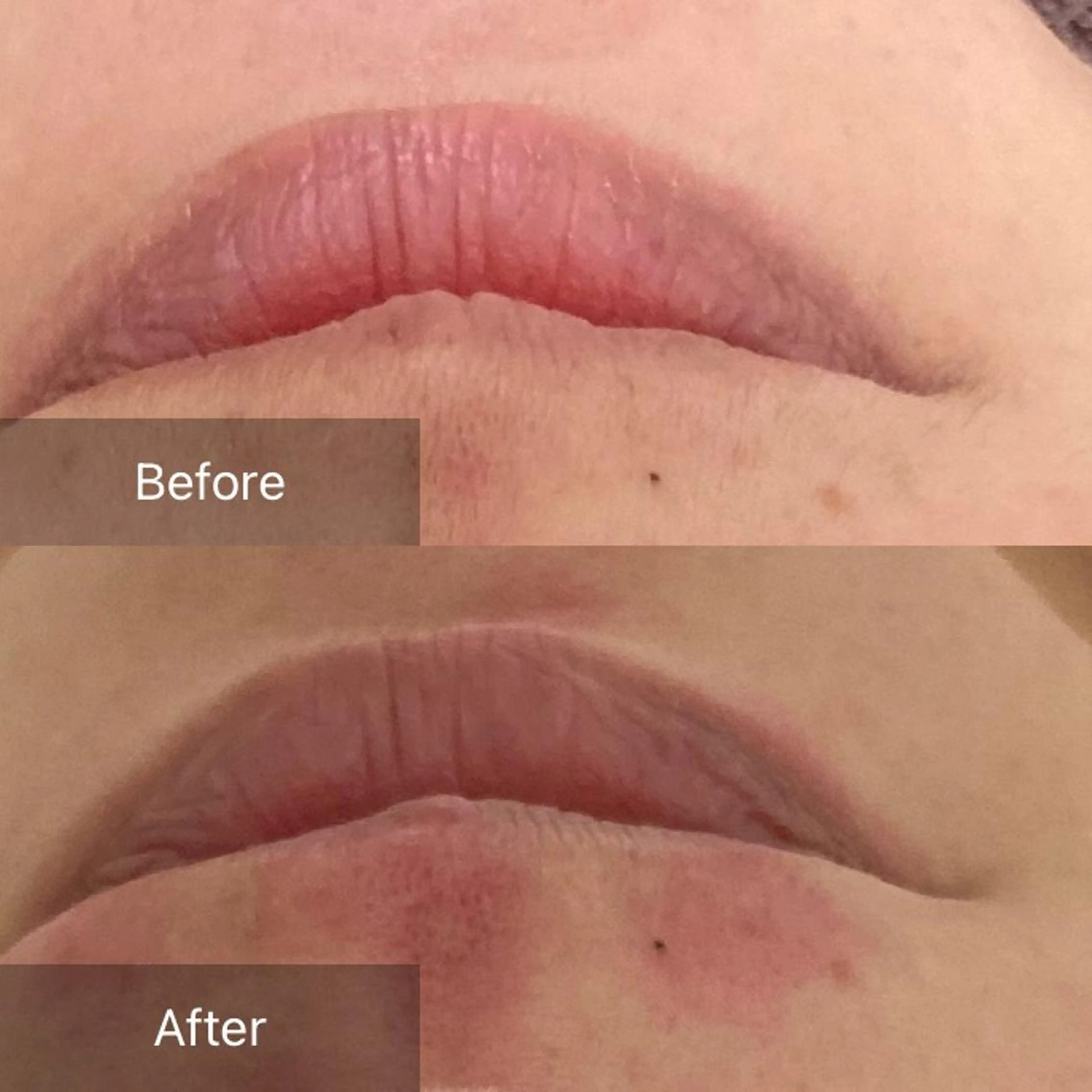 エステ 産毛専門店 Bittoのエステ・リラクイメージ