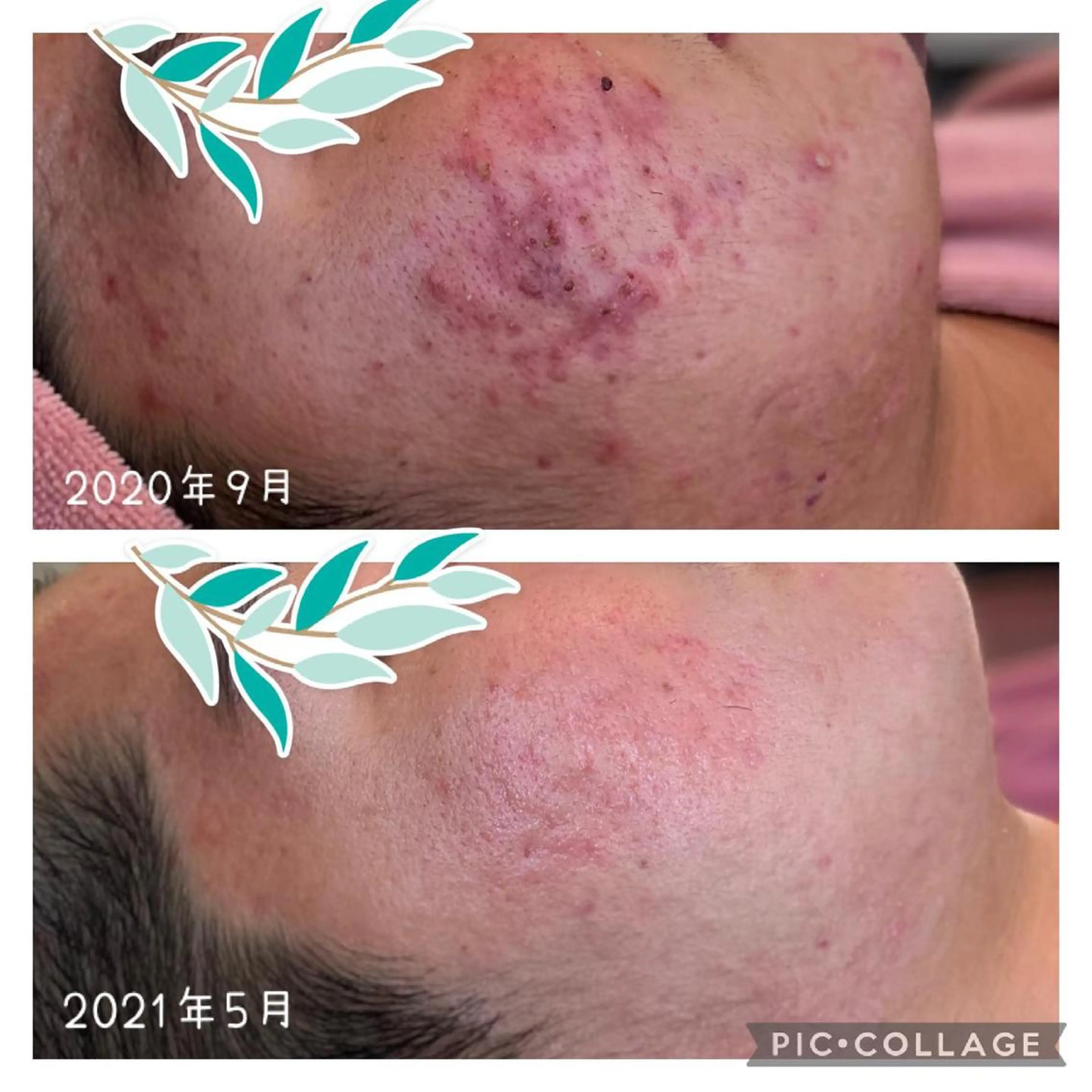 美肌蘇生カウンセラー 横山りえのエステ・リラクイメージ