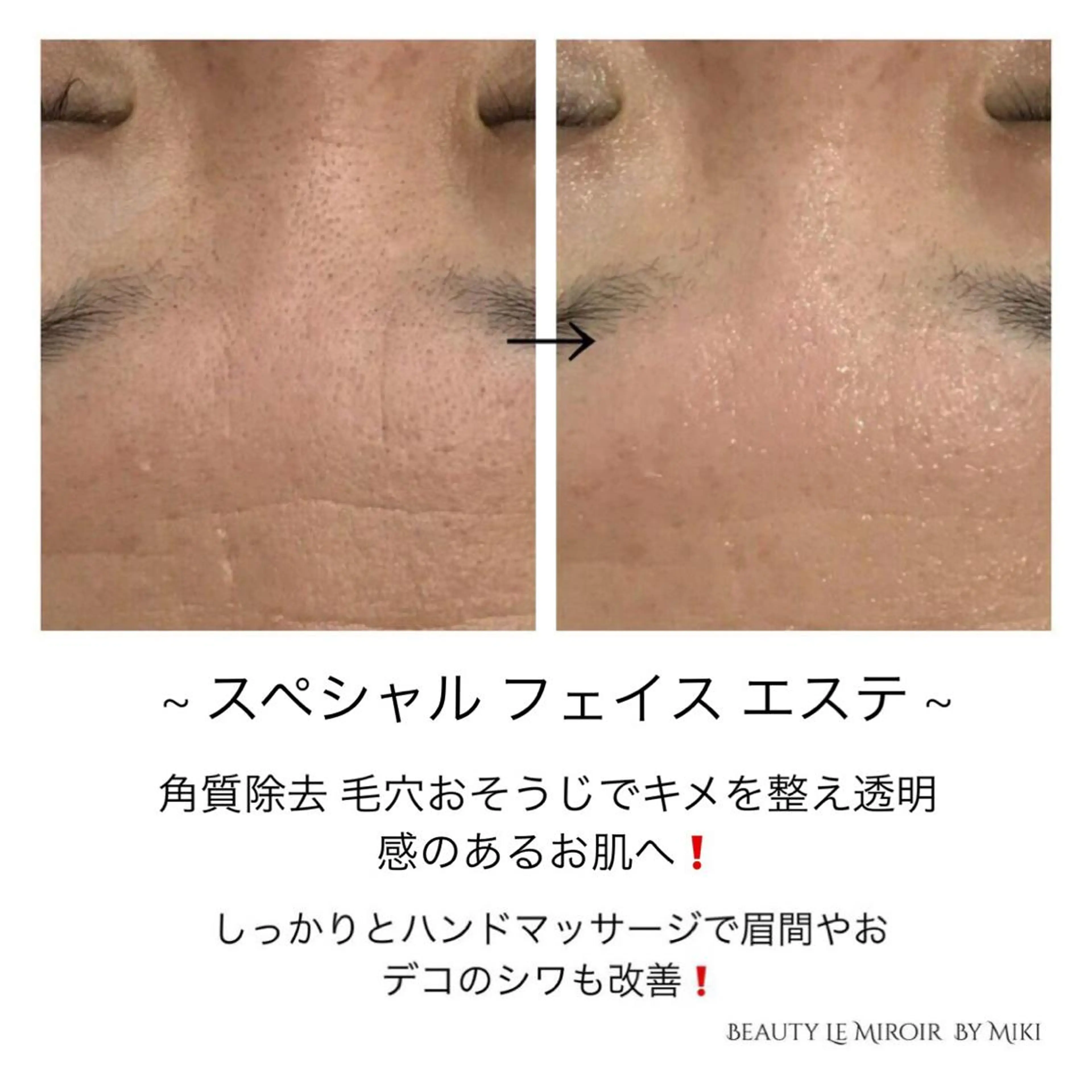 ビューティー ミロワールのエステ・リラクイメージ