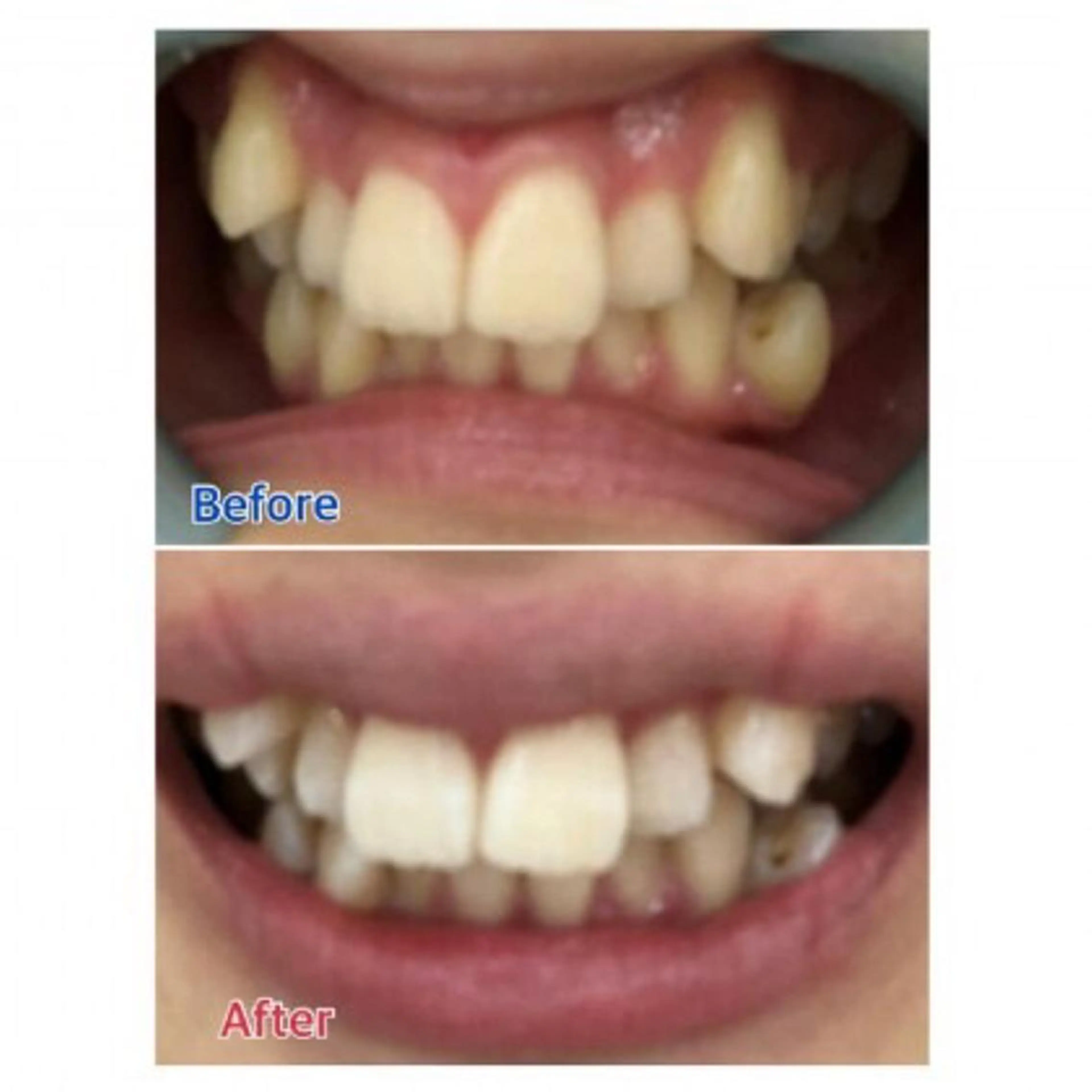 Ｍ渋谷 ホワイトニングのエステ・リラクイメージ