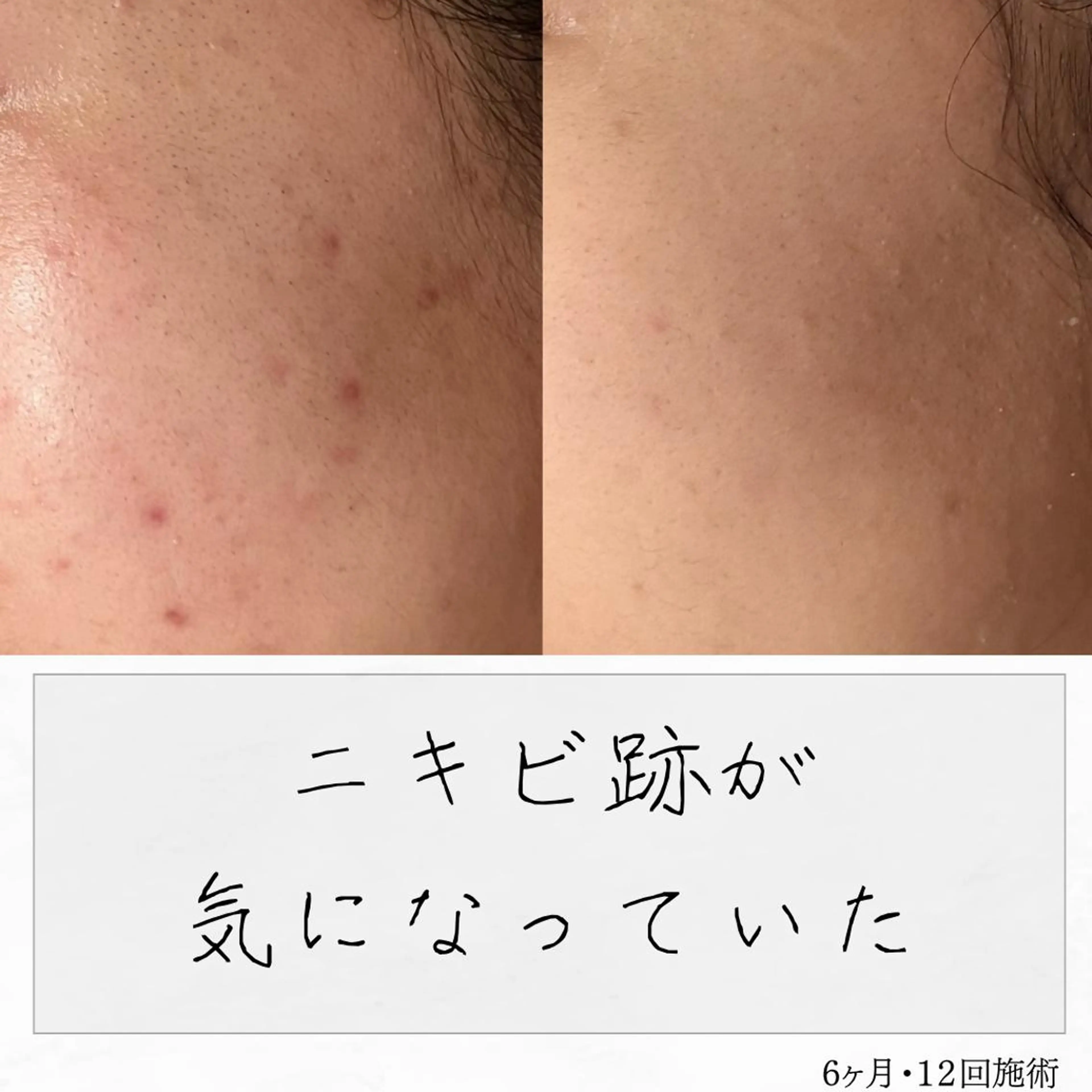 ニキビ経験者が施術 する専門サロン🌻のエステ・リラクイメージ