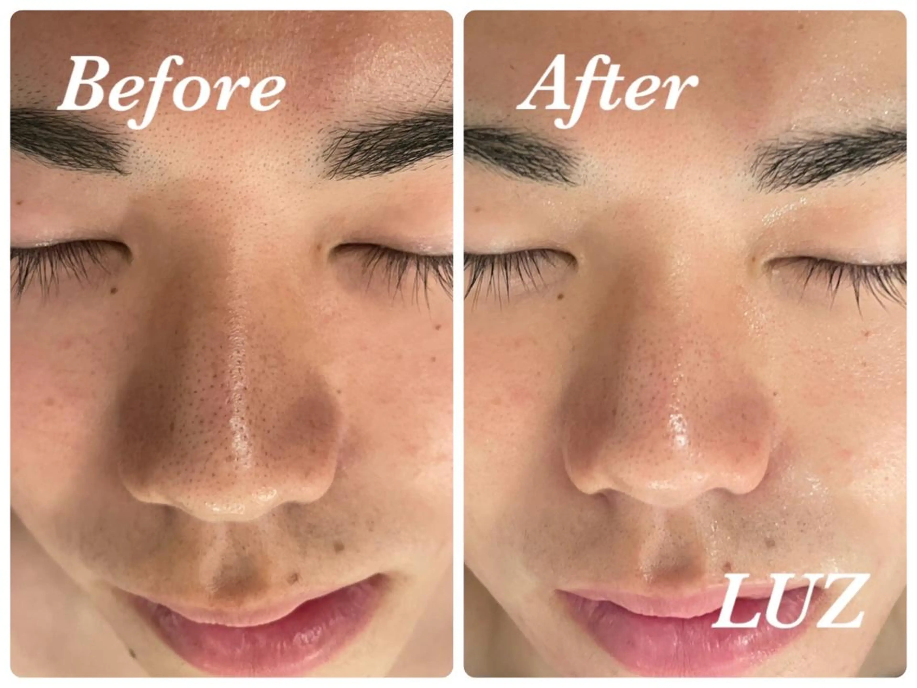 メンズ メンズフェイシャル アイブロウ・ルースのエステ・リラクイメージ