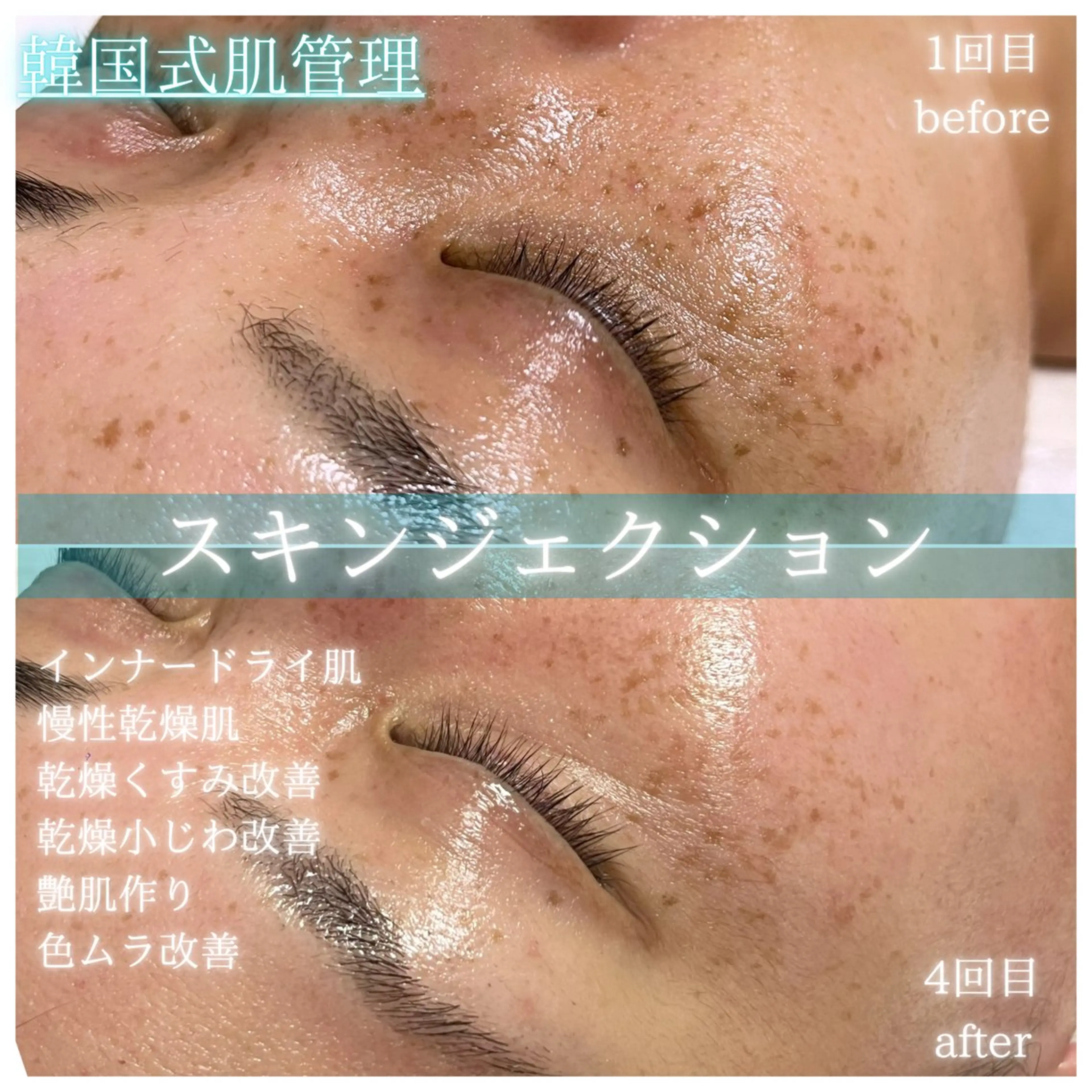 エステ リラク La Dusa 韓国肌管理/小波のエステ・リラクイメージ