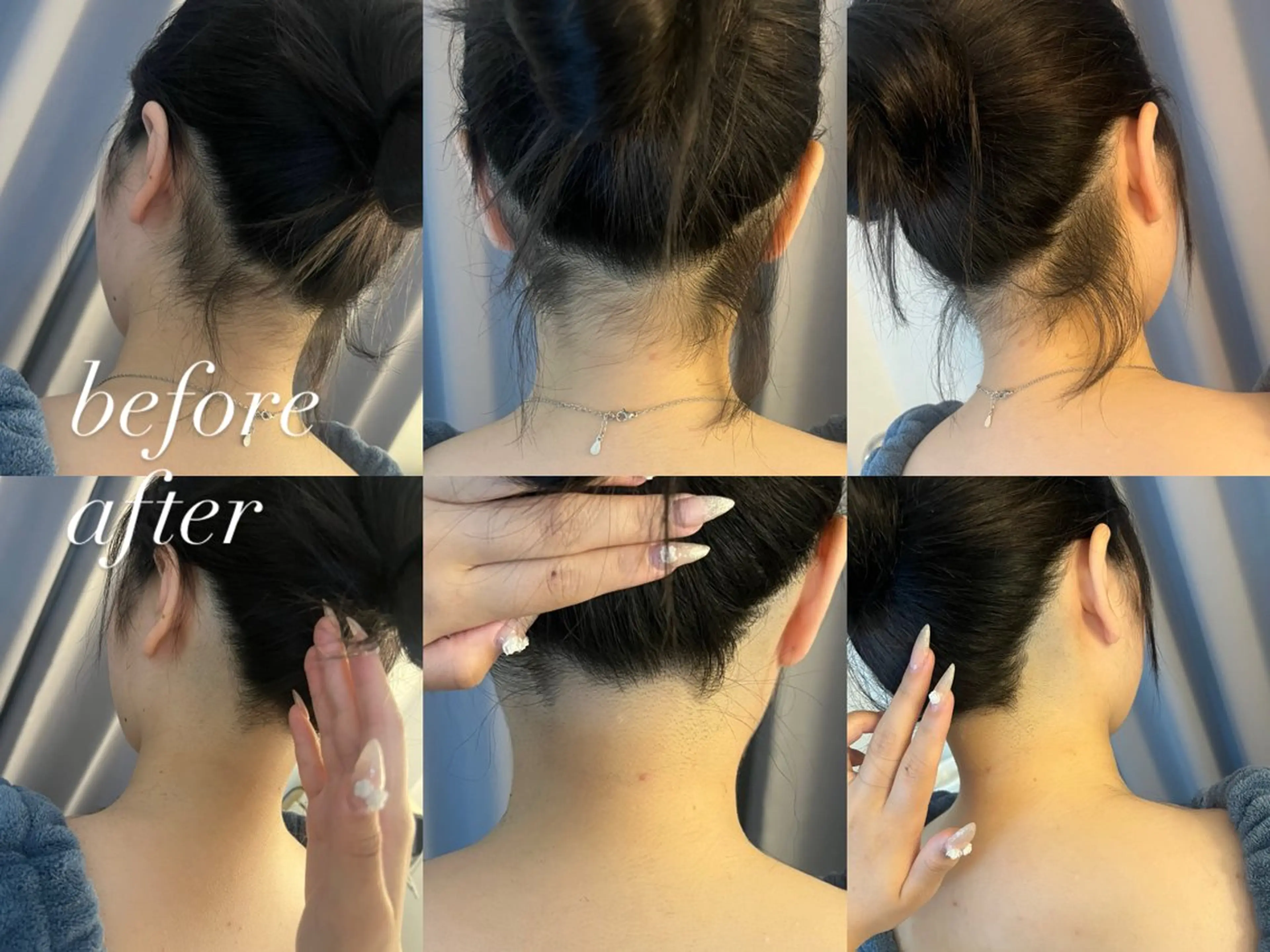 うなじ脱毛/美肌脱毛 LABELのエステ・リラクイメージ