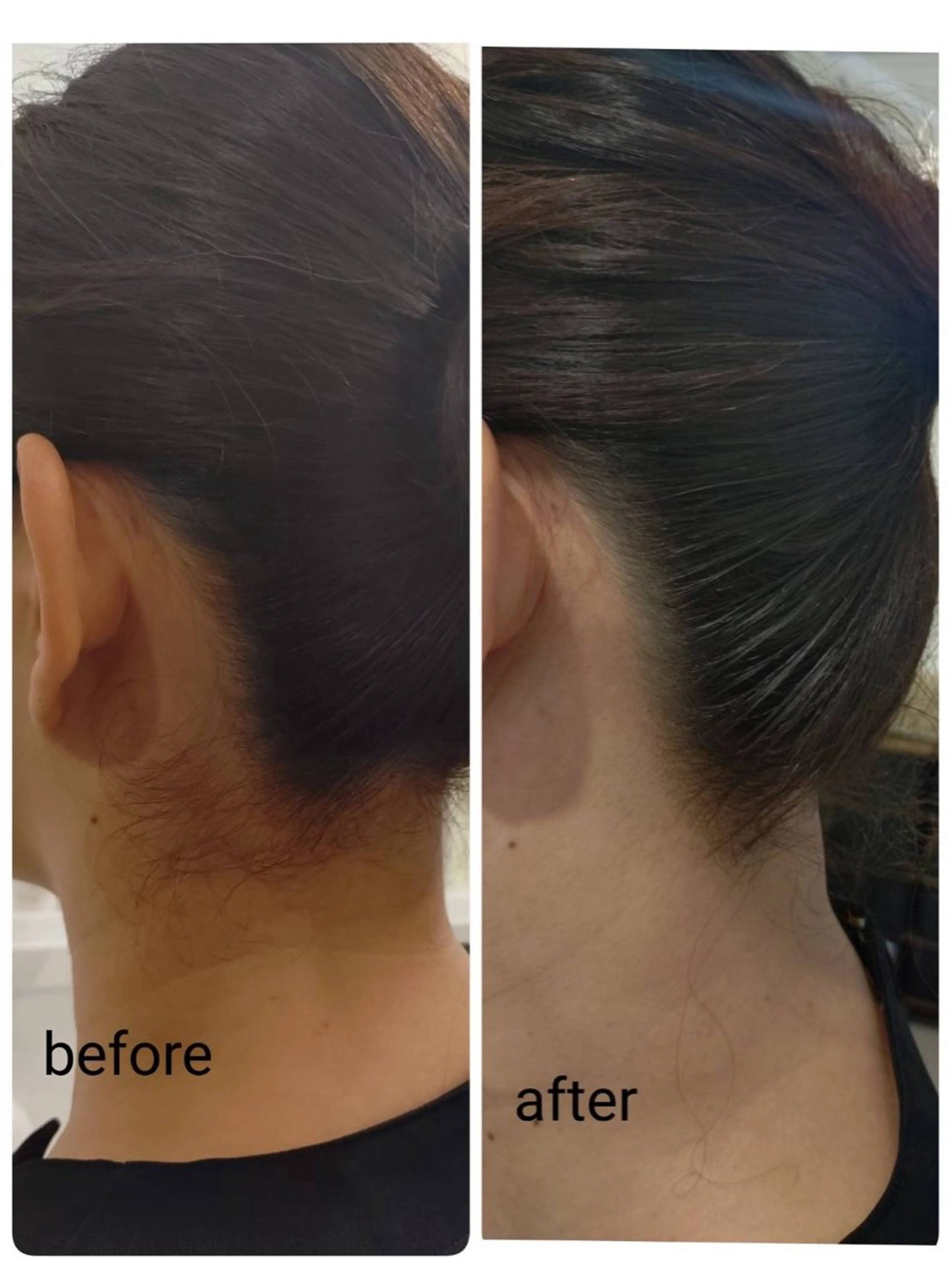 脱毛 辻 恵理のエステ・リラクイメージ