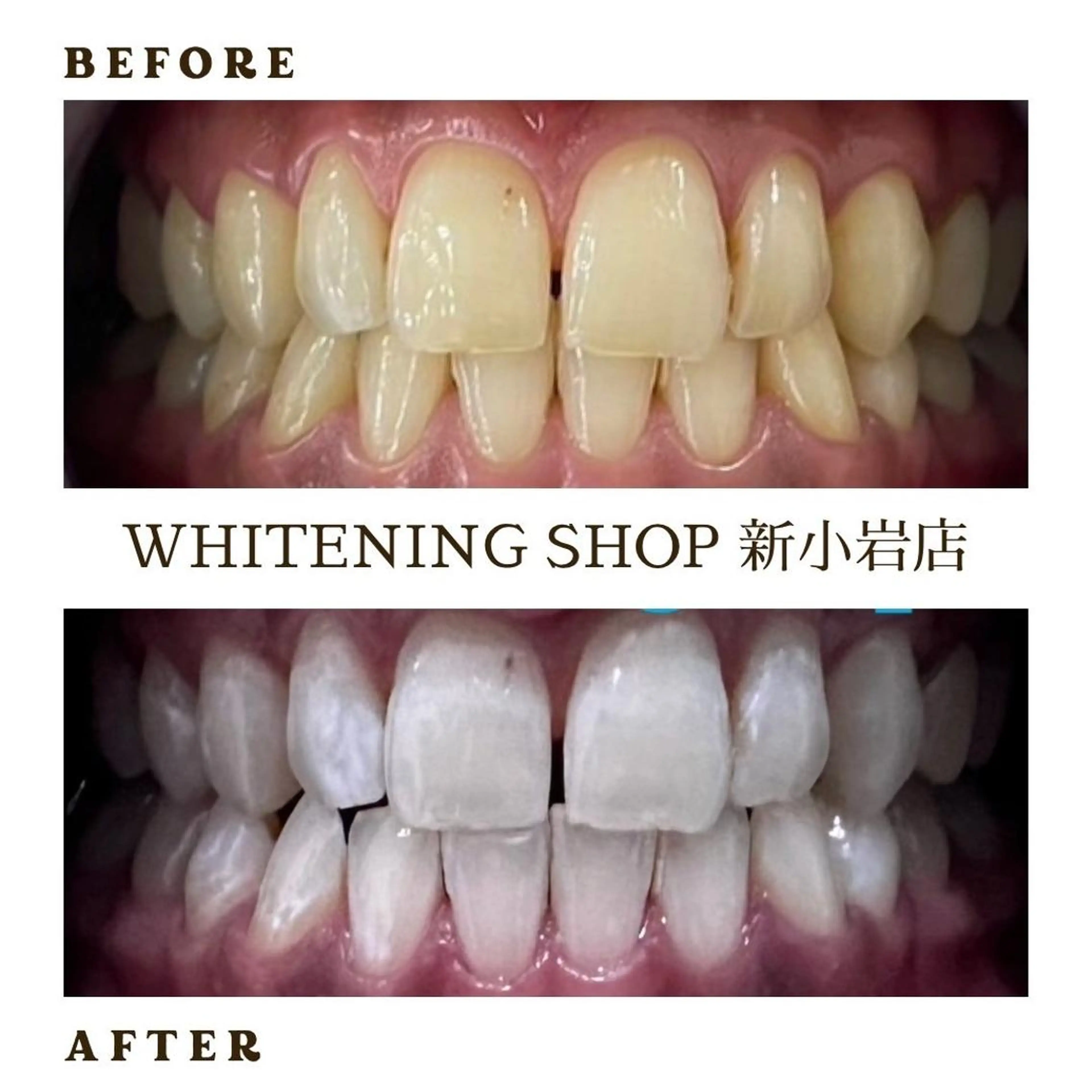 メンズ その他 ホワイトニング ショップ新小岩店のその他イメージ