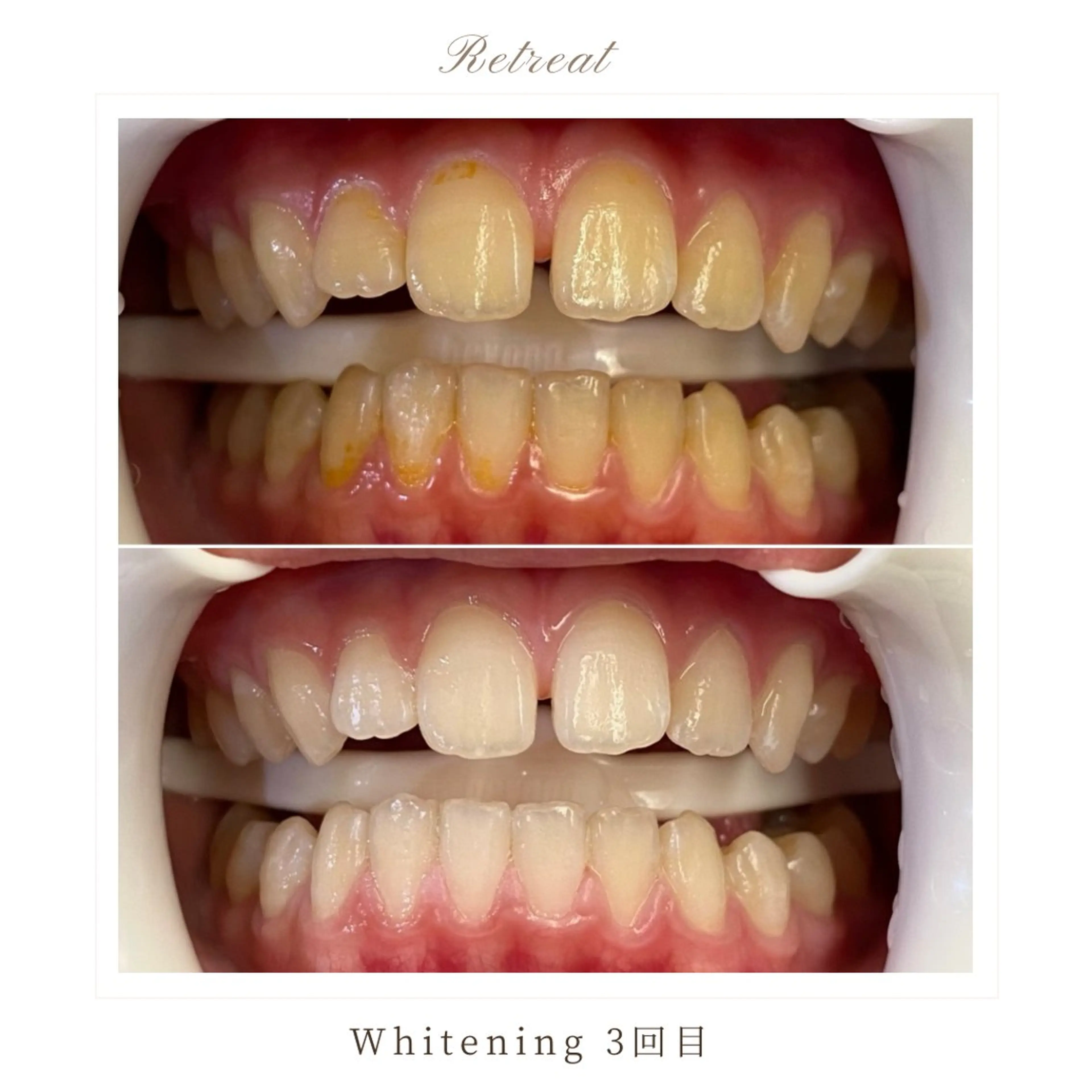 メンズ キッズ 歯科医院提携 Retreatのエステ・リラクイメージ