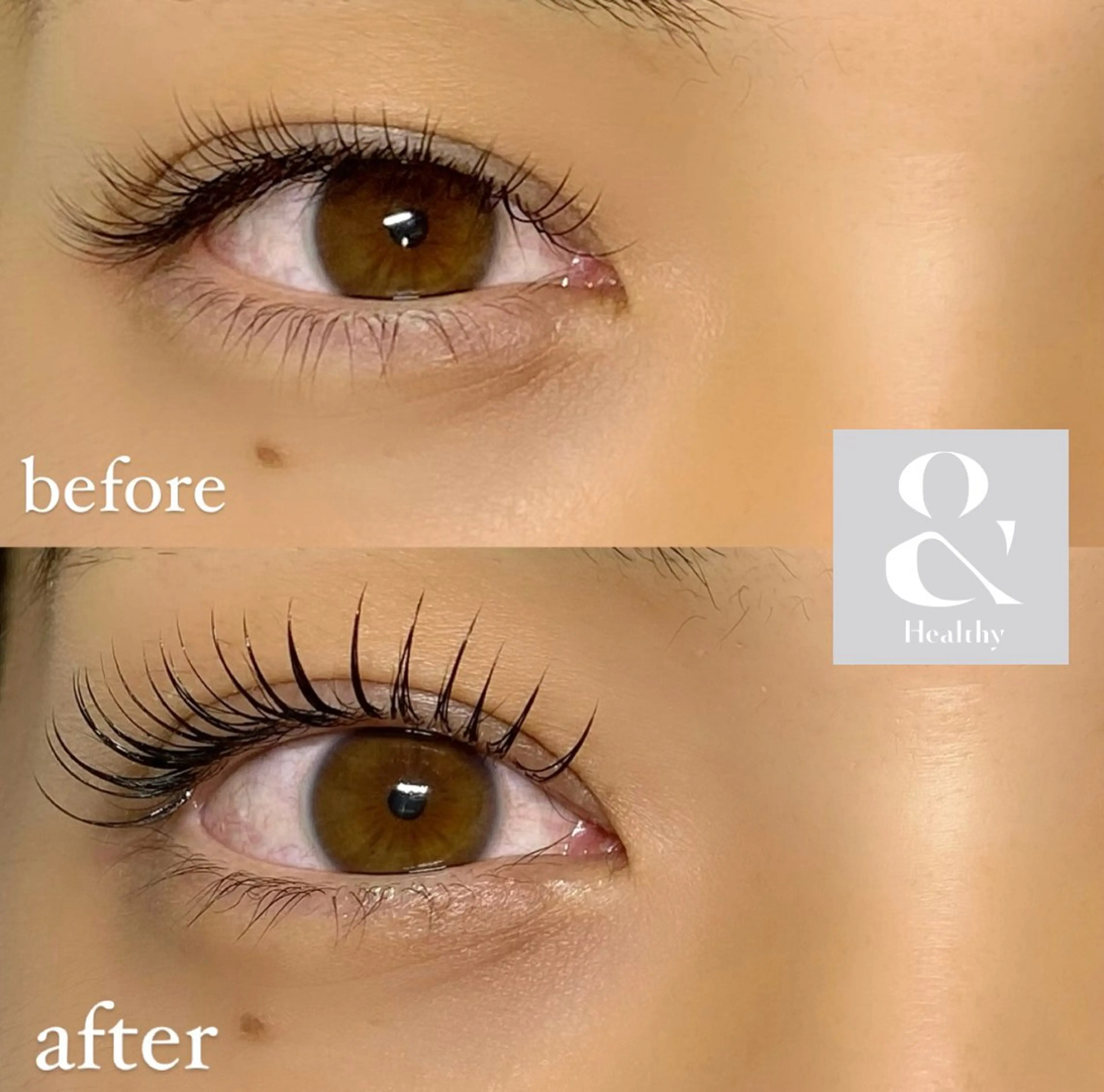 4月限定🌷🌸&healthy(ｱﾝﾄﾞﾍﾙｼｰ)➕フラット100本🌼【ｵﾌ込み】の写真