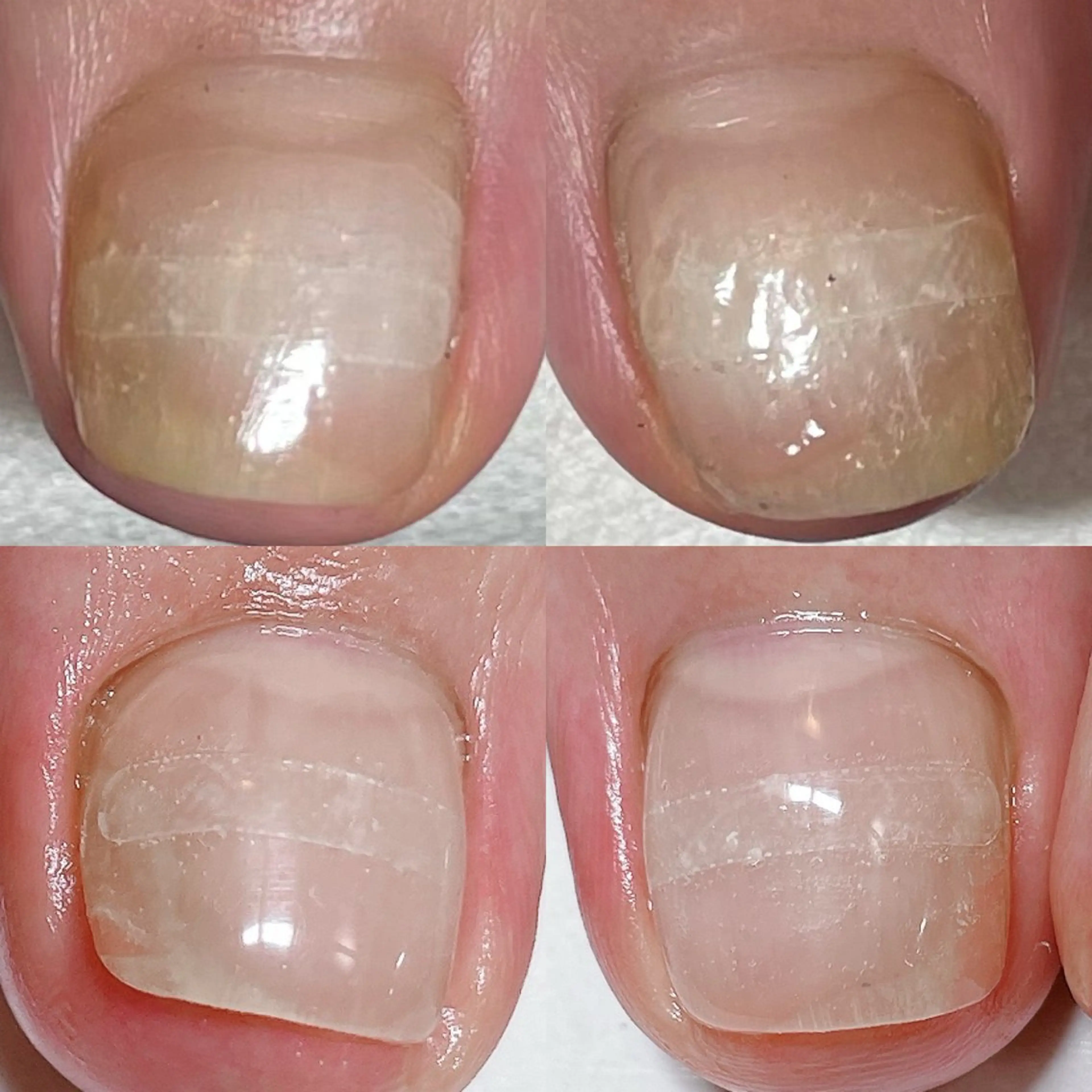 ネイル フットネイル .Nails Mio 赤羽西ネイルサロンのネイルデザイン