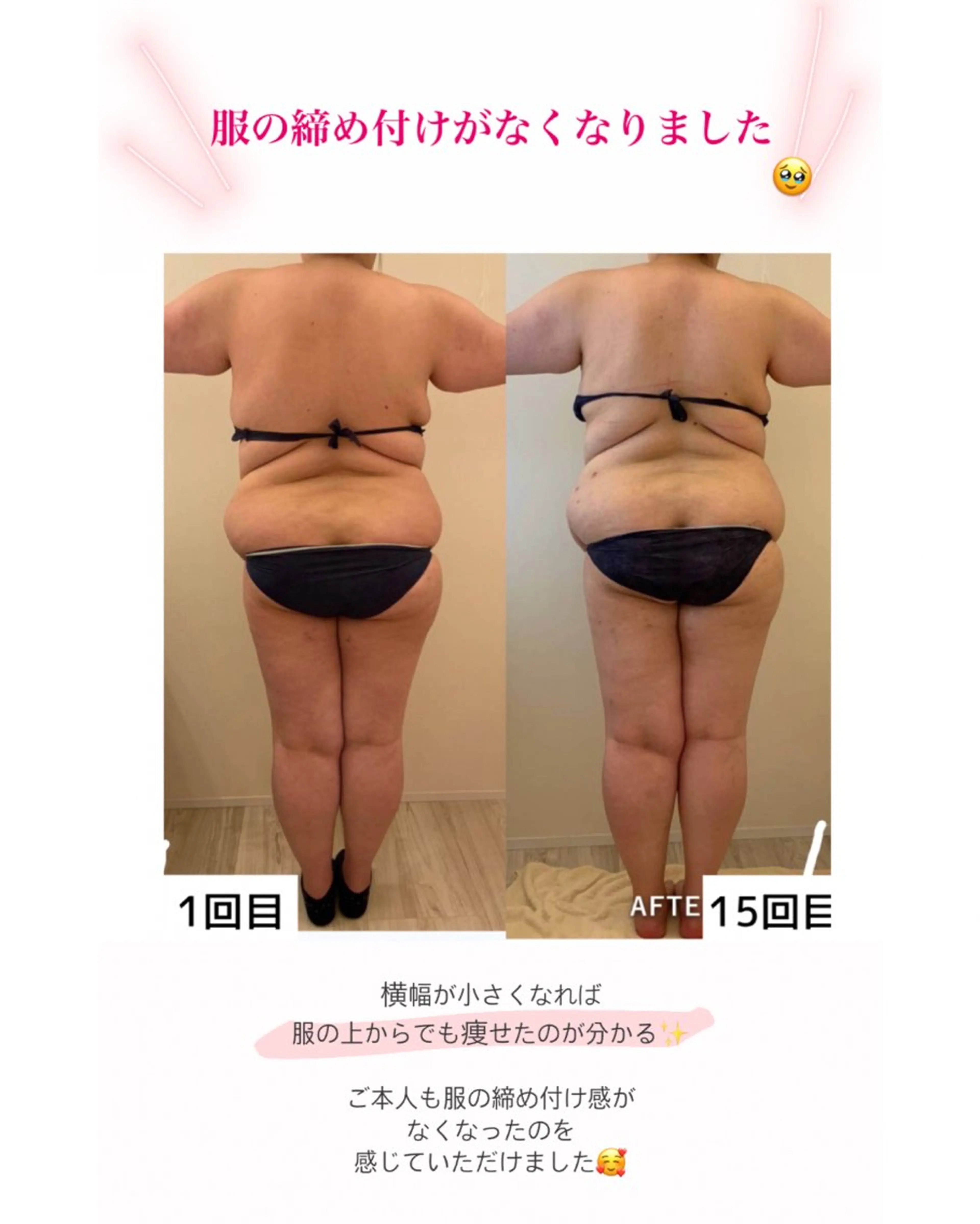 産後ダイエット−9㎏ Pourvous結衣のエステ・リラクイメージ