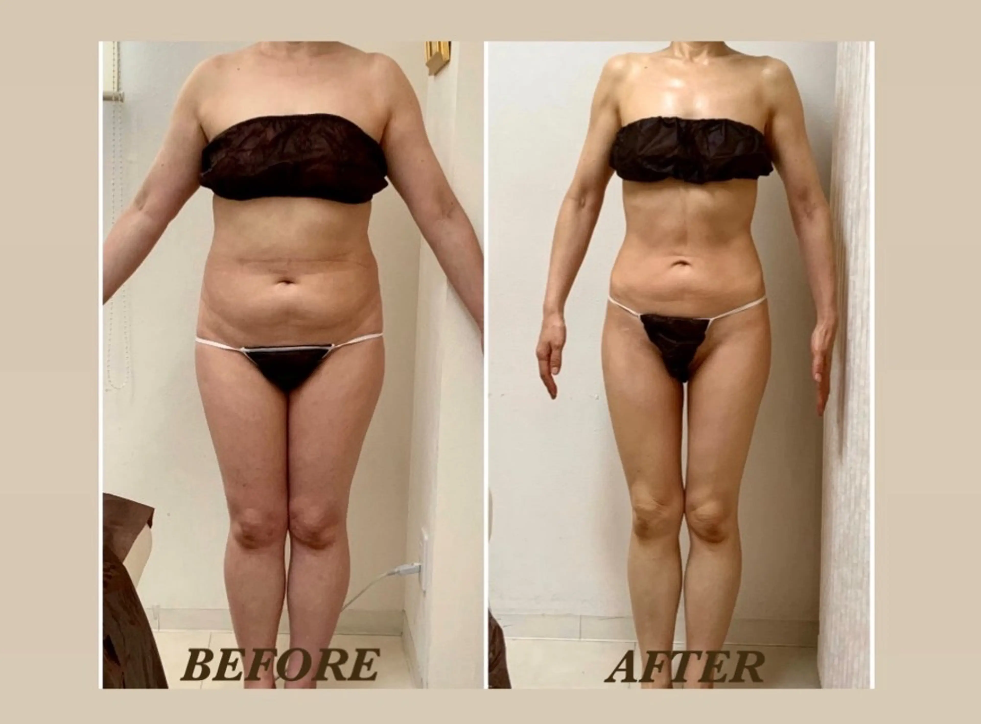 エステ リラク Prima〜プリマ〜 名古屋駅店所属・Prima 痩身脱毛 にごうかおりのエステ・リラクイメージ