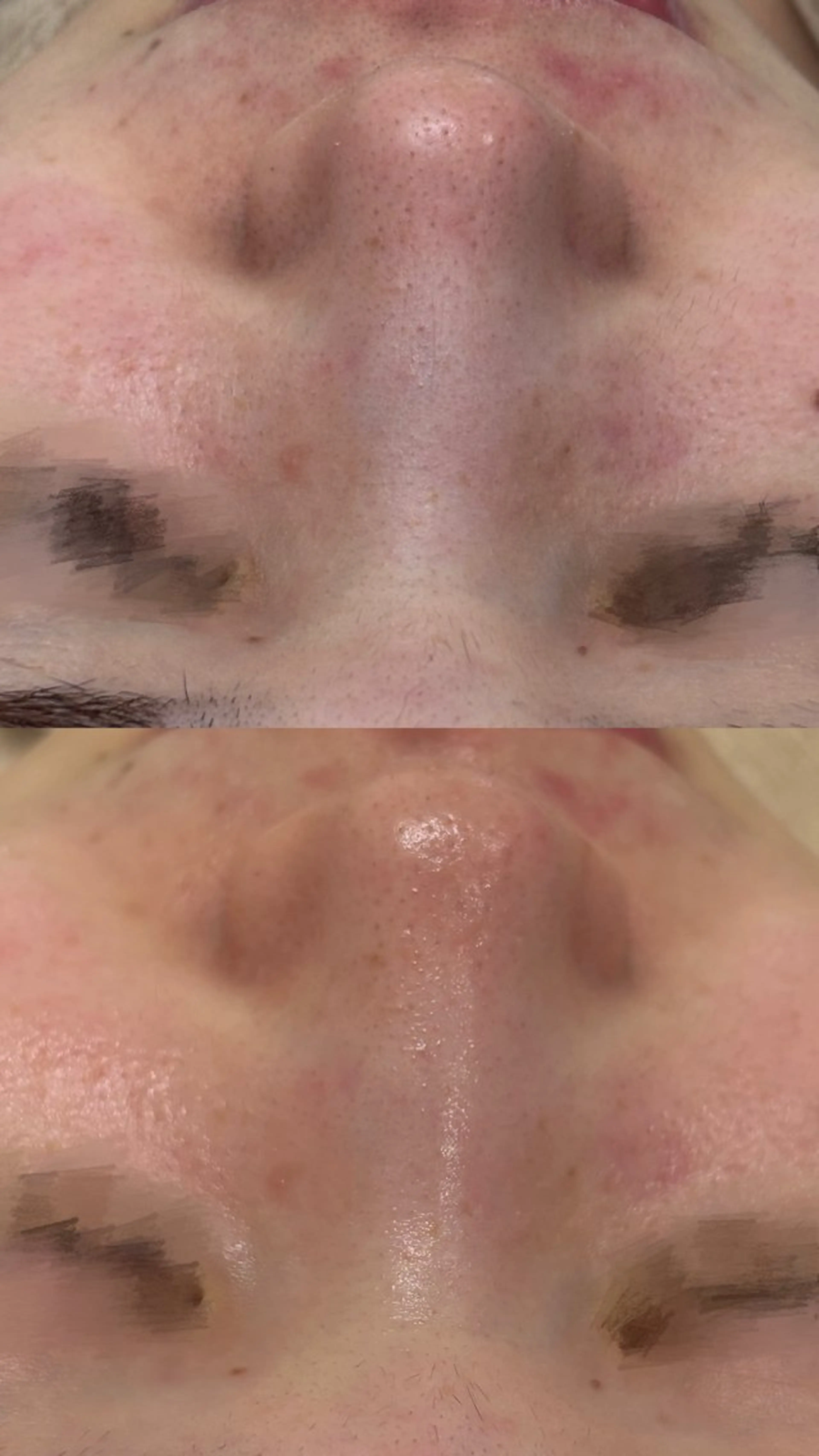 エステ 鈴木 りいなのエステ・リラクイメージ