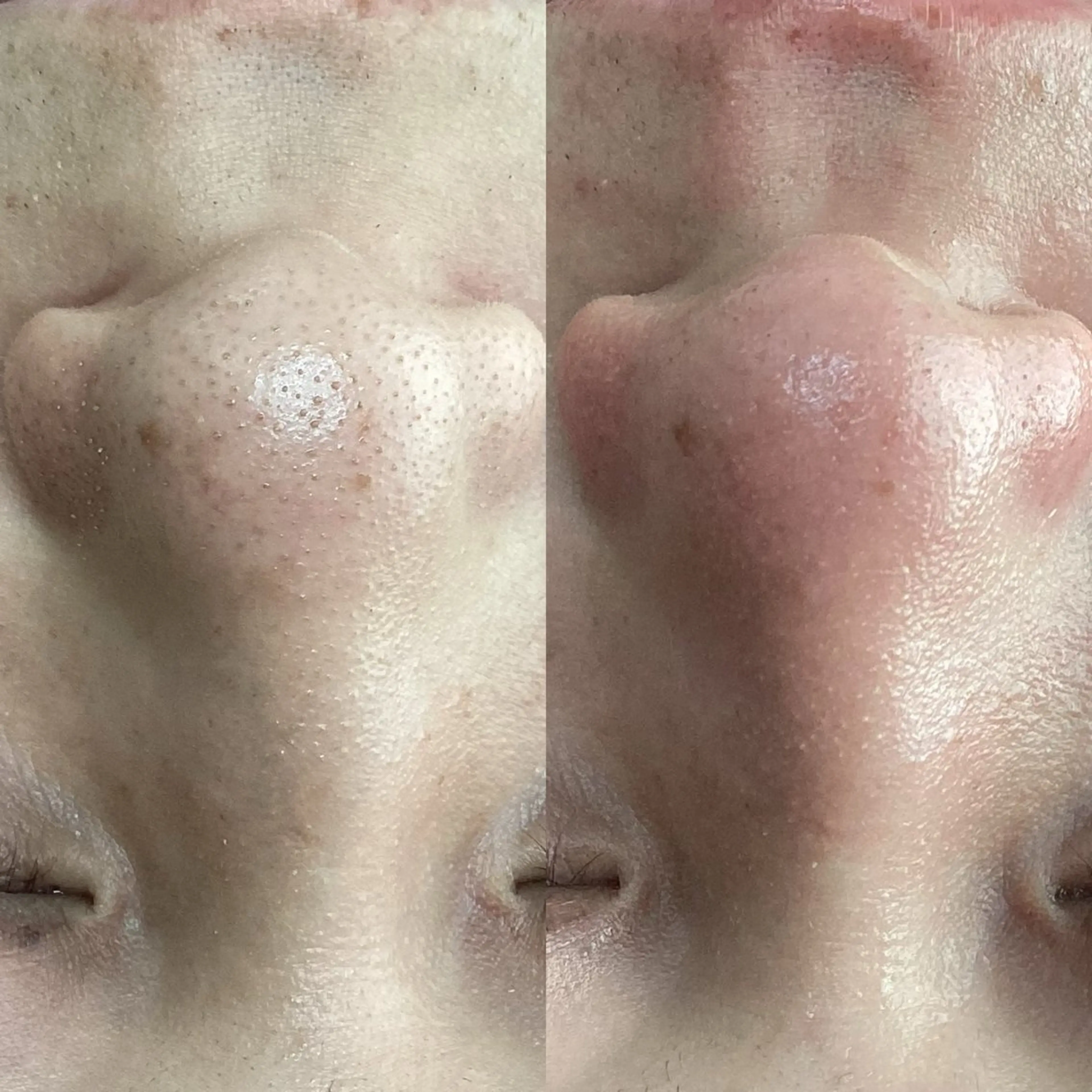 エステ Rifuro毛穴ケア &よもぎ蒸しサロンの眉毛・アイブロウイメージ