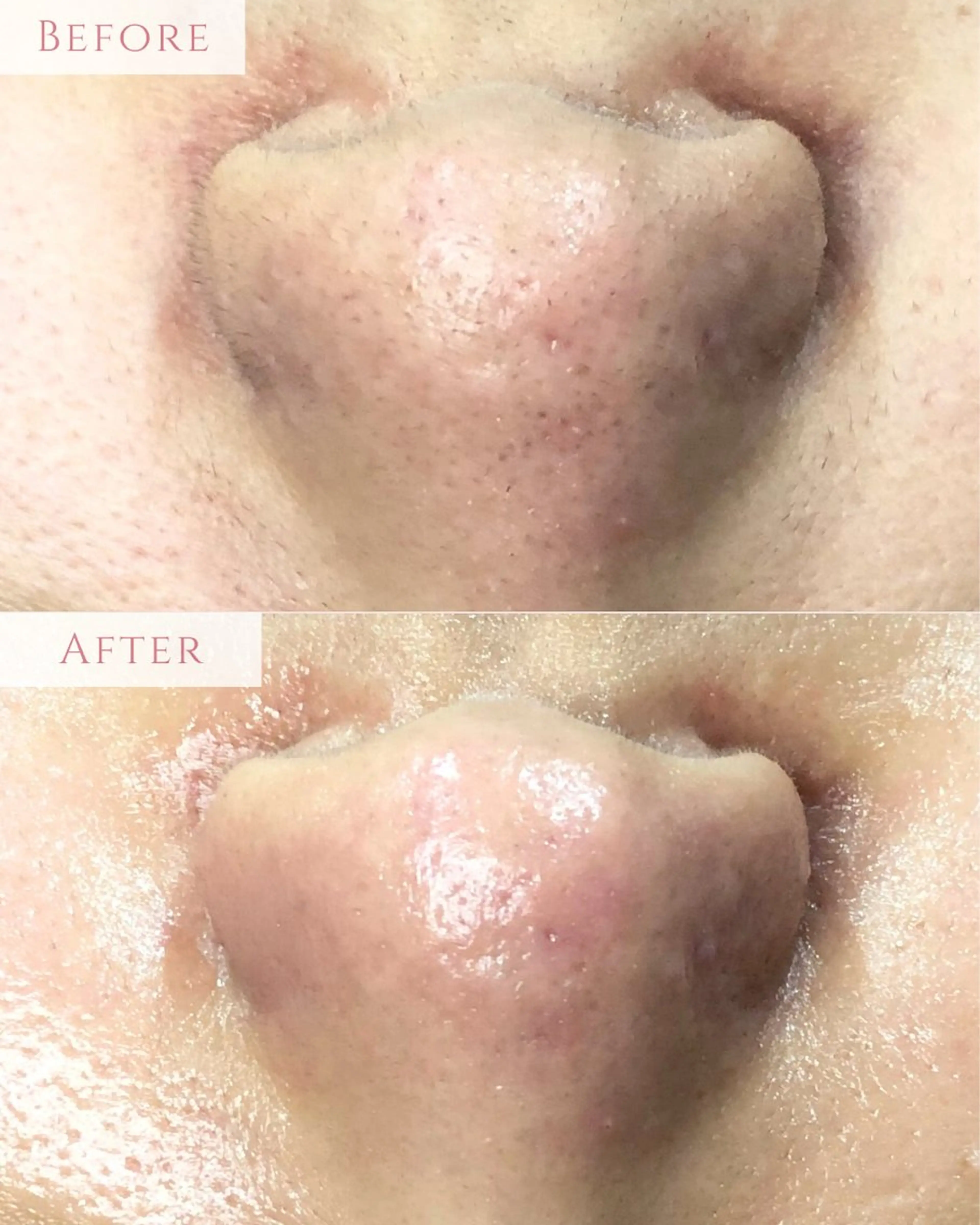 脱毛 肌質改善専門サロン Bellmi/心斎橋のエステ・リラクイメージ