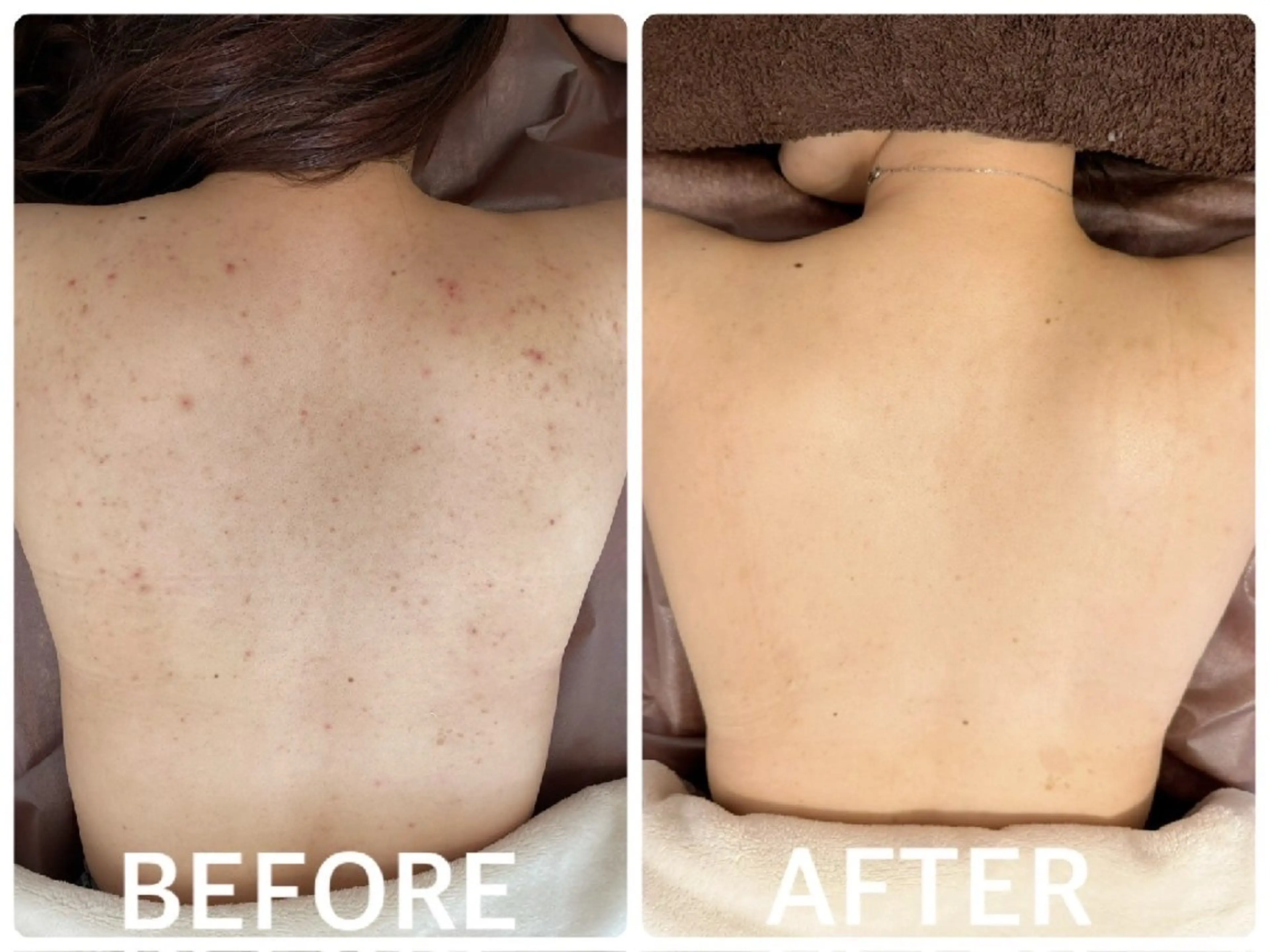 ハーブピーリング横浜 肌質改善専門店のその他イメージ