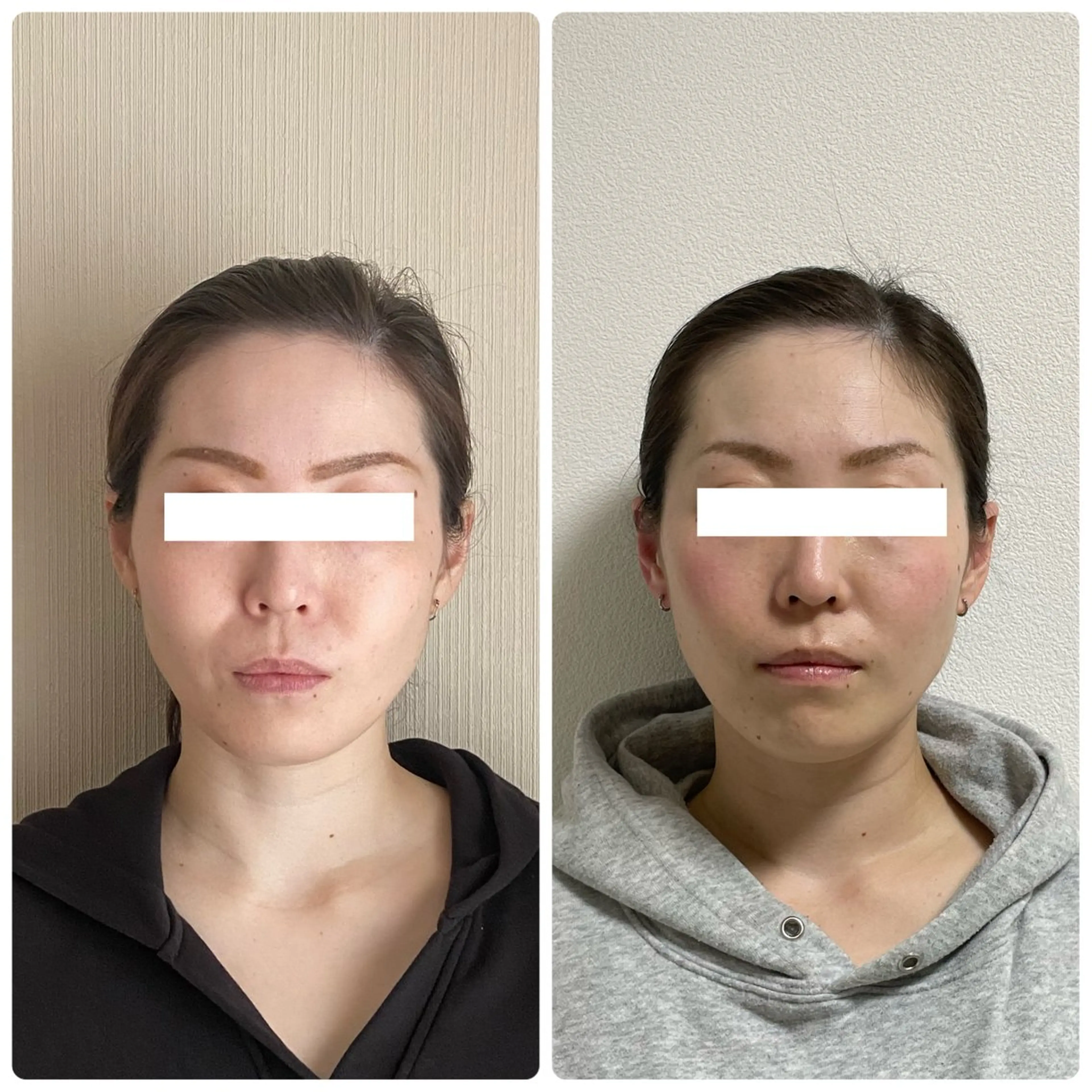 片山けいこ｜ 美人顔創りの専門家のエステ・リラクイメージ