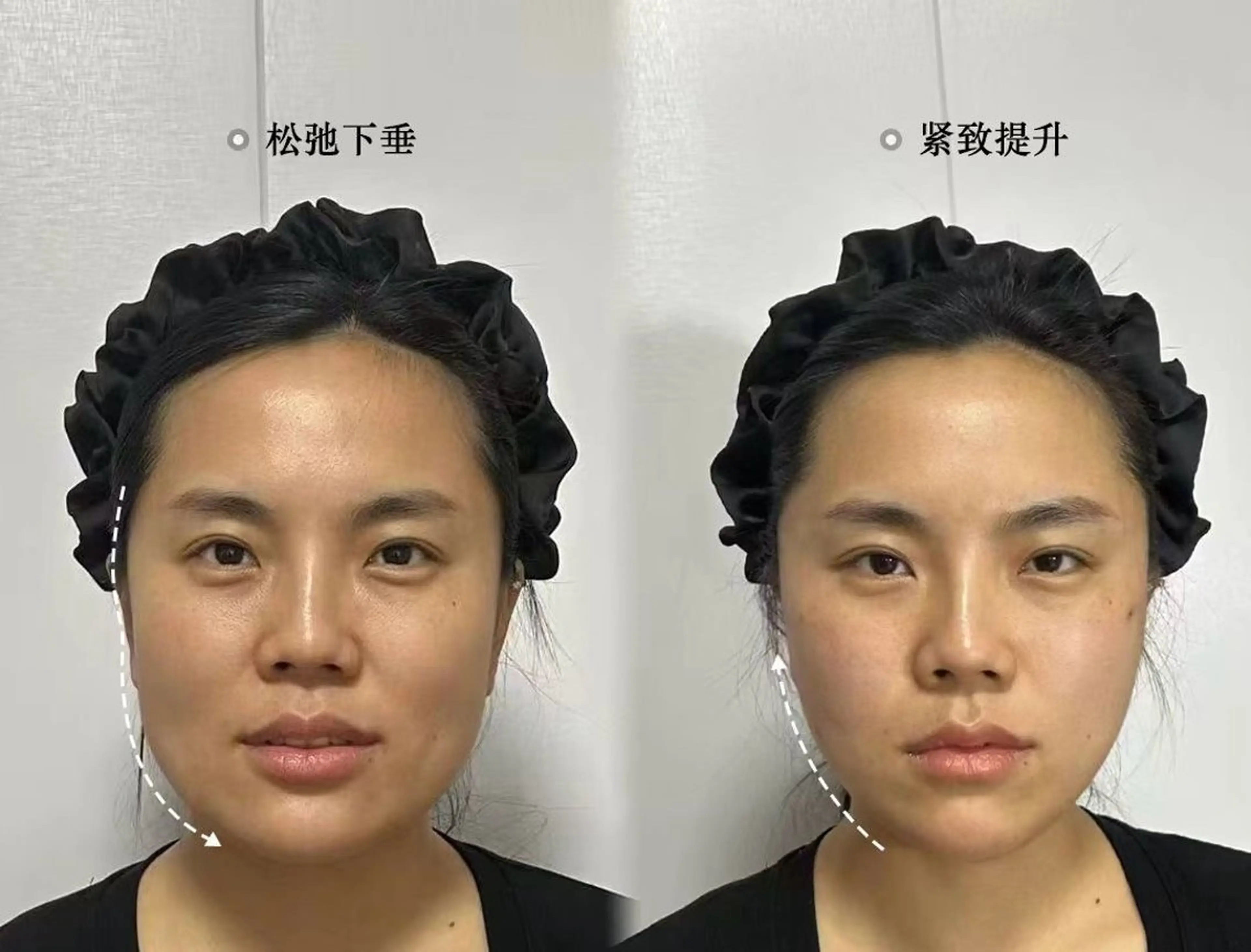 ショート エステ aliaハイフ&水光ジェットサロン所属・aliaハーブ水光店 エステティシャン募集のエステ・リラクイメージ