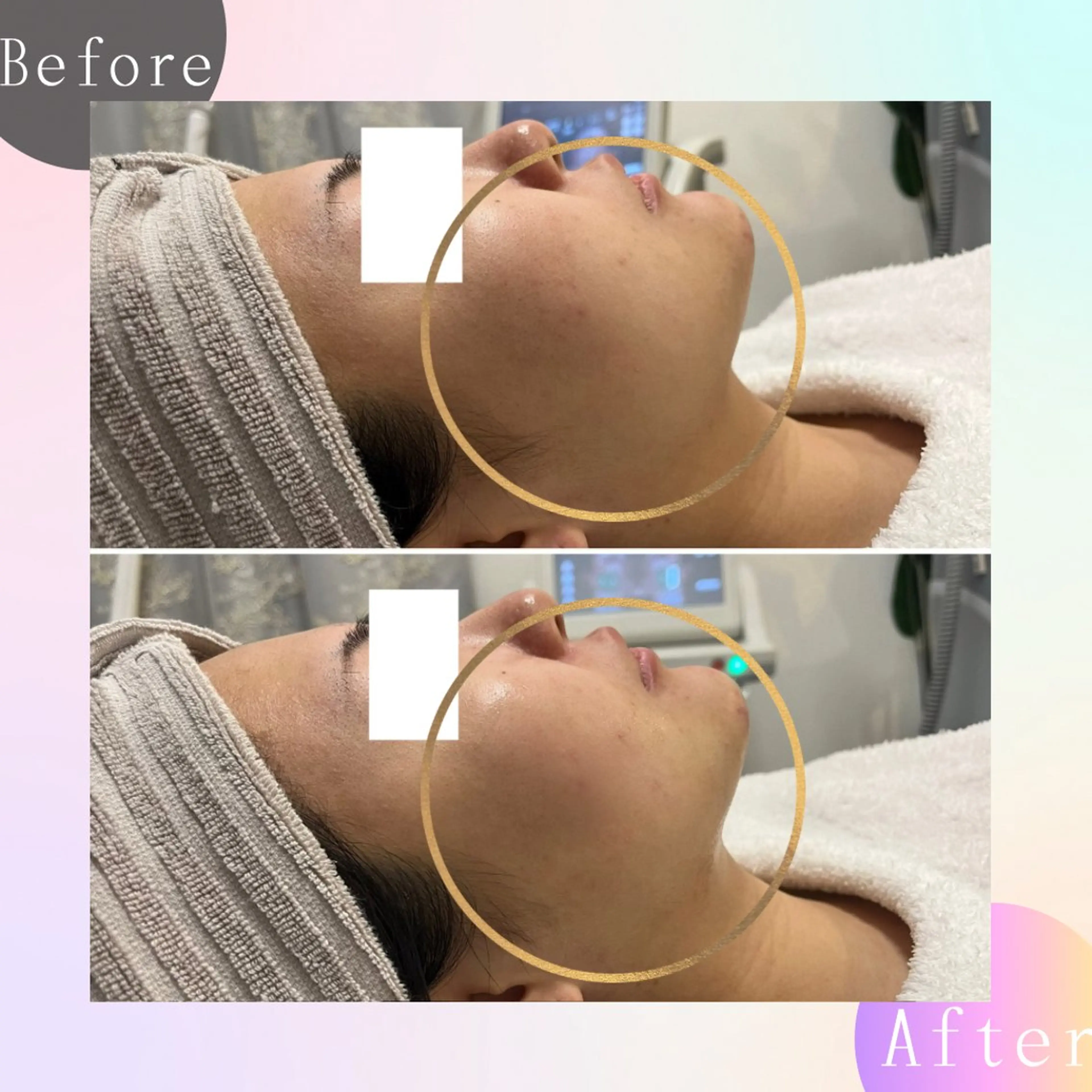 エステ Freyia Beautyのエステ・リラクイメージ