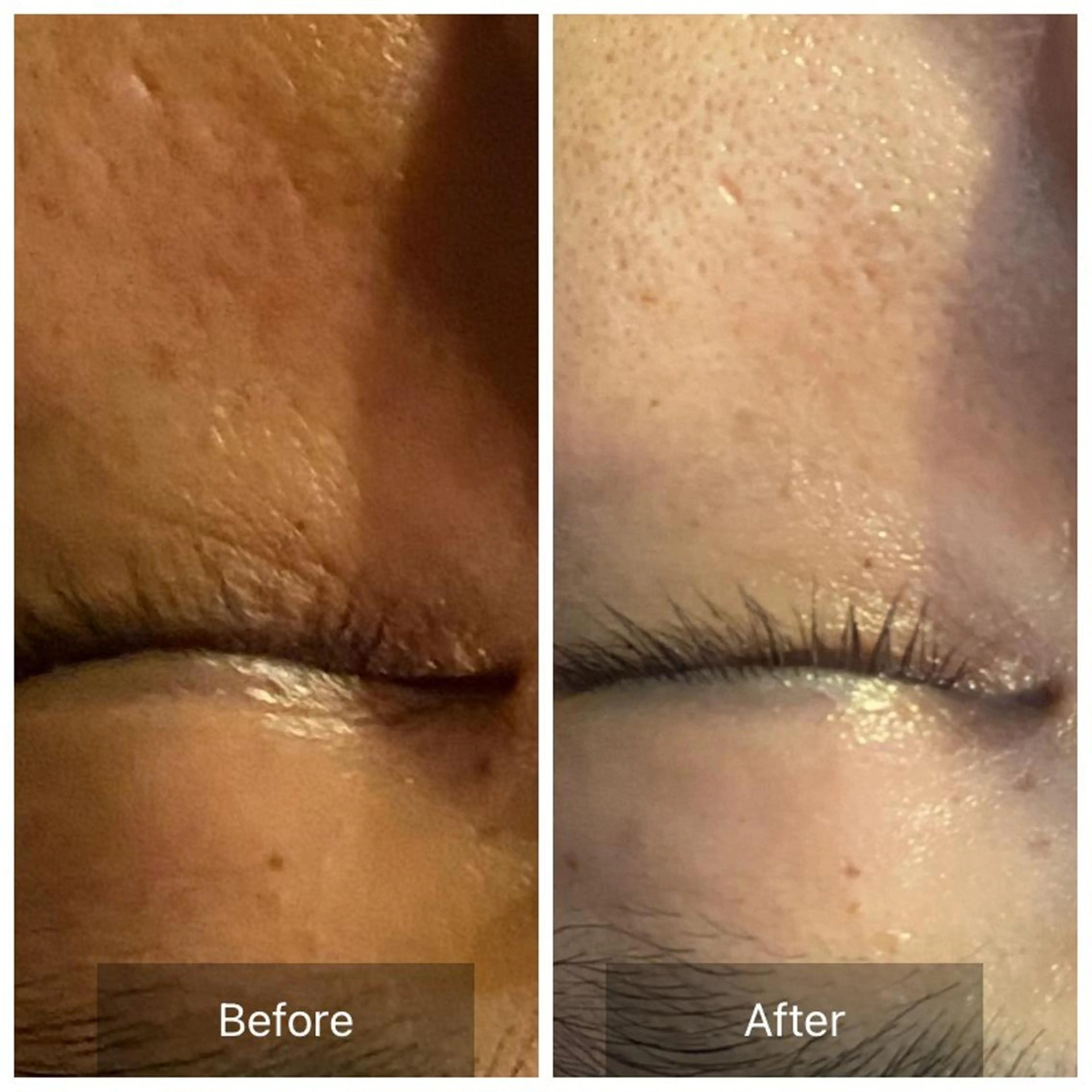 毛穴から始める肌メン テマンダリンオレンジのエステ・リラクイメージ