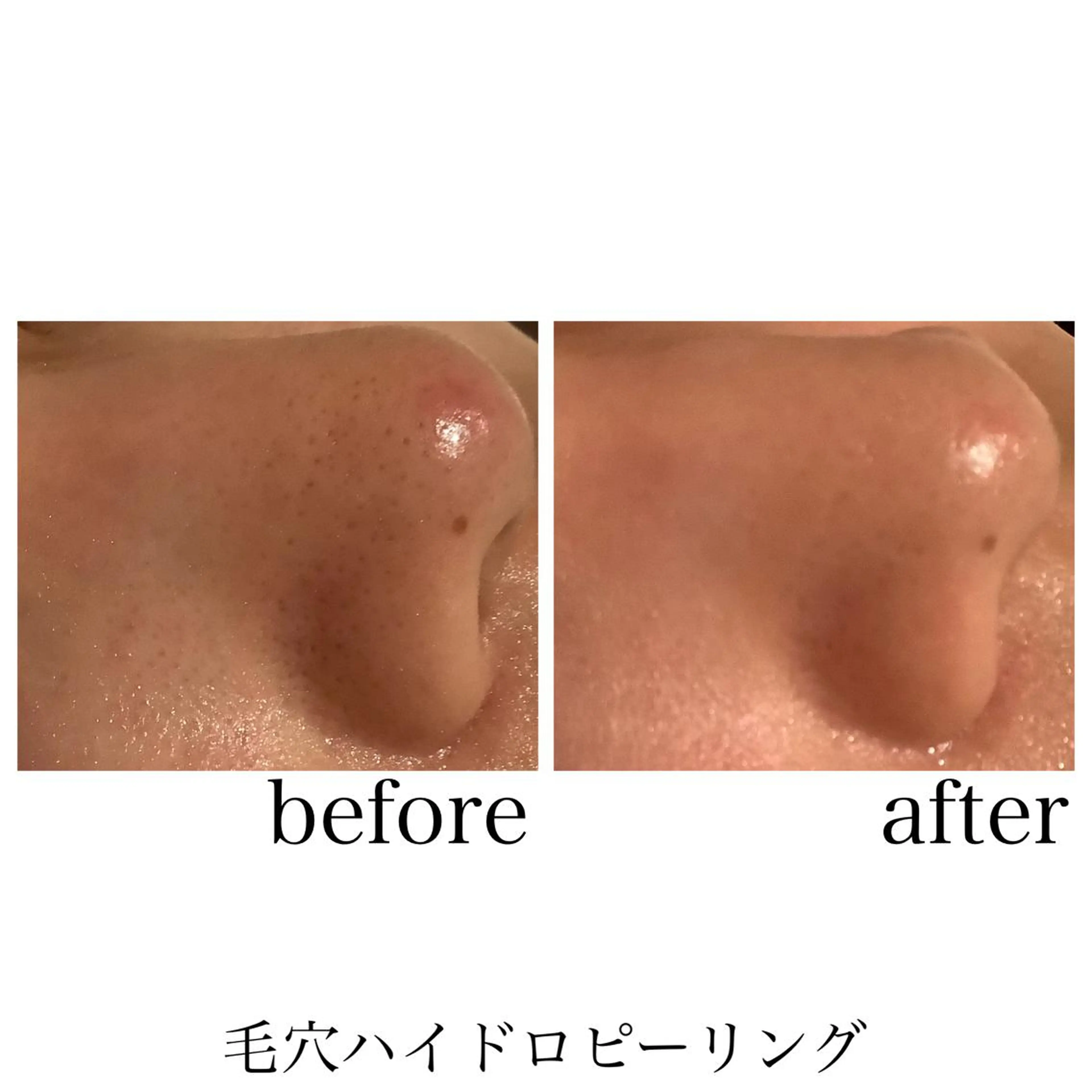 脱毛&エステサロン JIGGLY武蔵小山のエステ・リラクイメージ